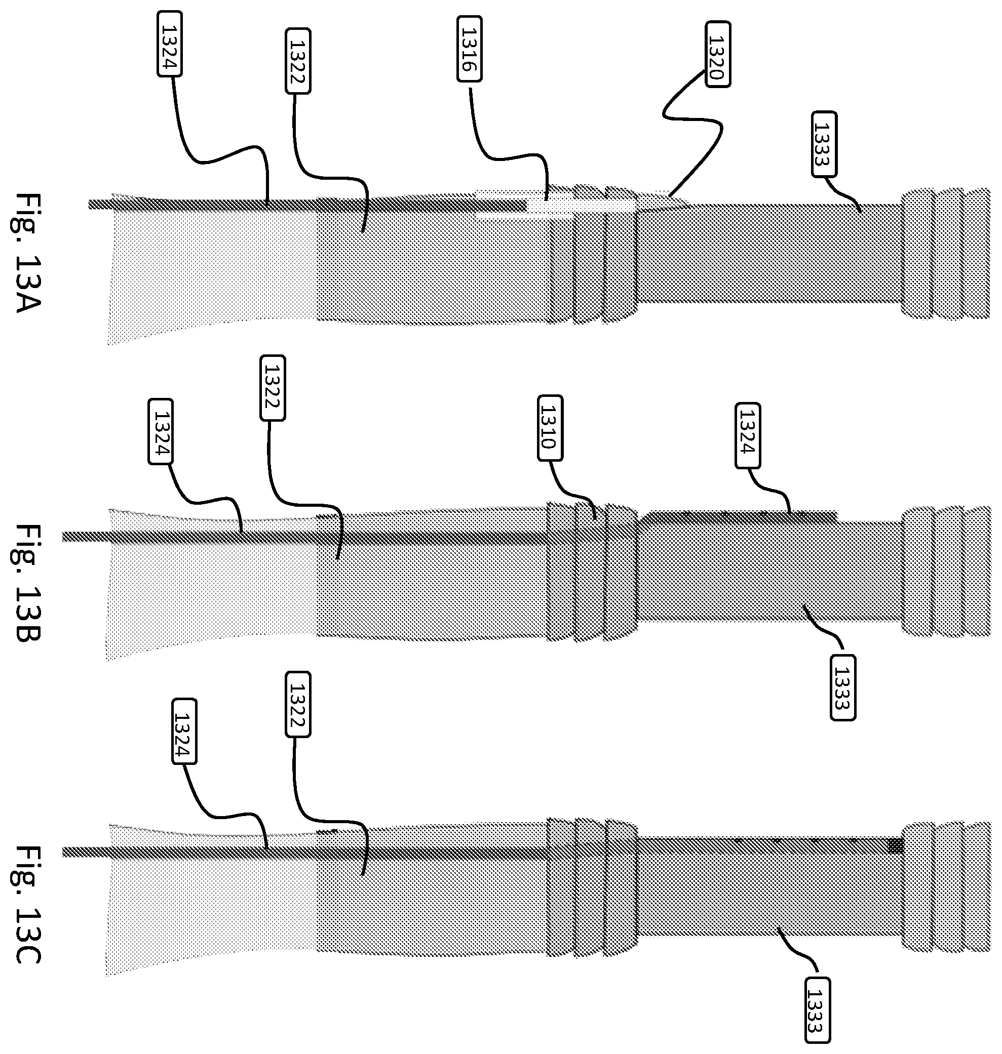 Patent US12508151 Figure 13 – Devices and methods for anchoring a sheath in a tissue cavity