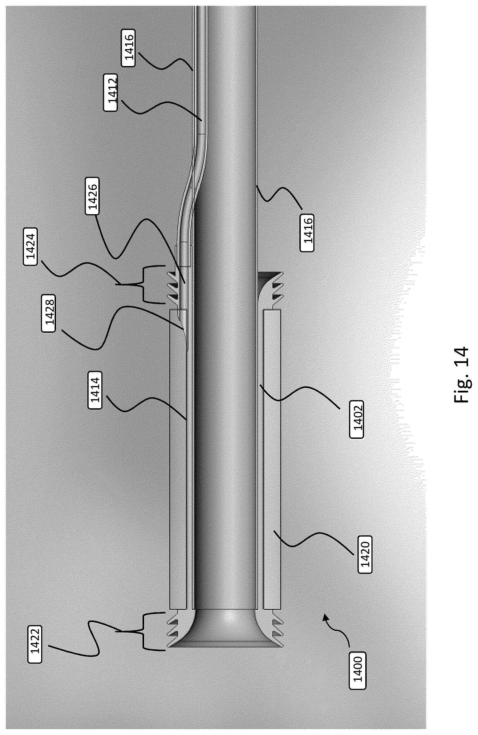 Patent US12508151 Figure 14 – Devices and methods for anchoring a sheath in a tissue cavity