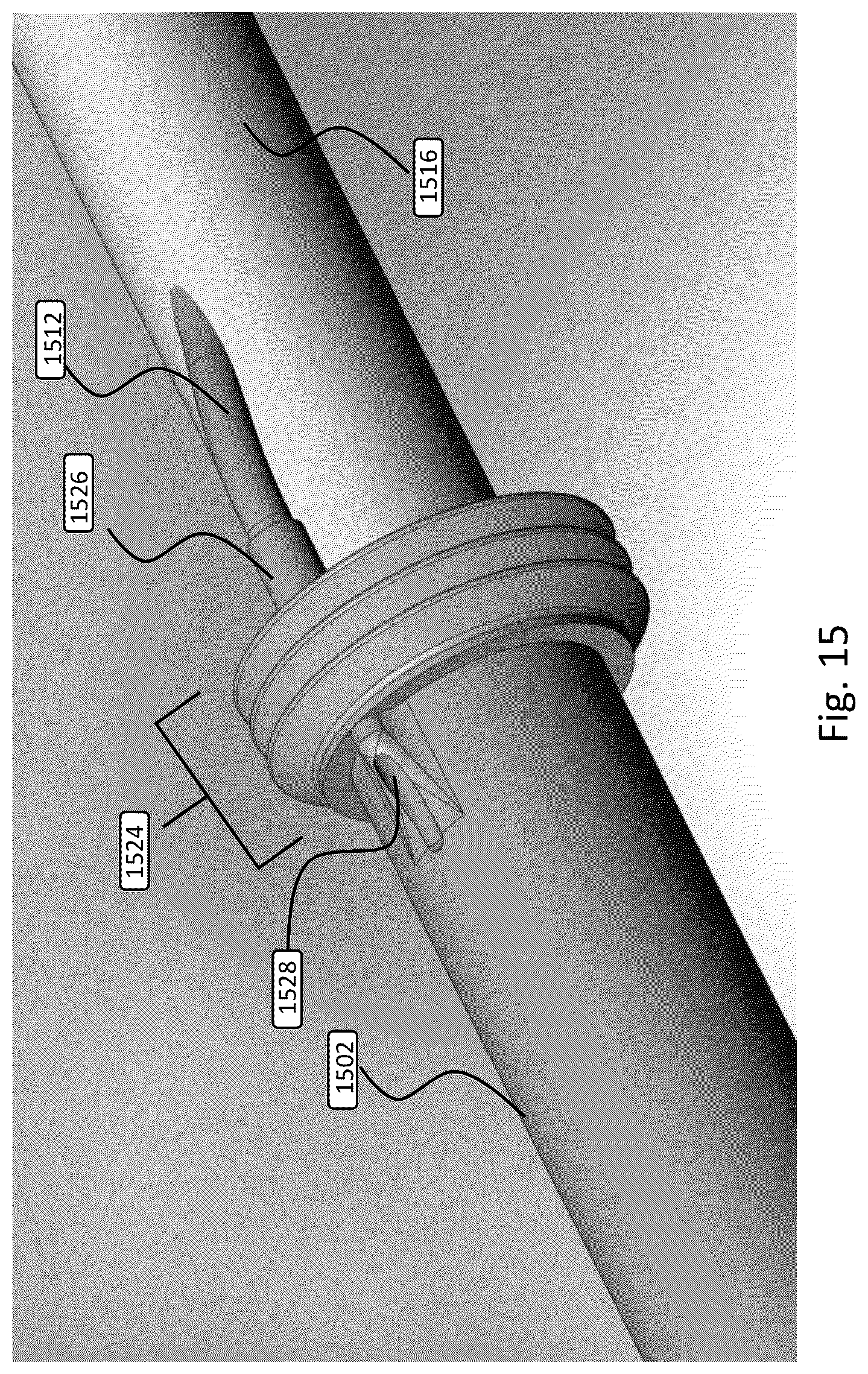 Patent US12508151 Figure 15 – Devices and methods for anchoring a sheath in a tissue cavity