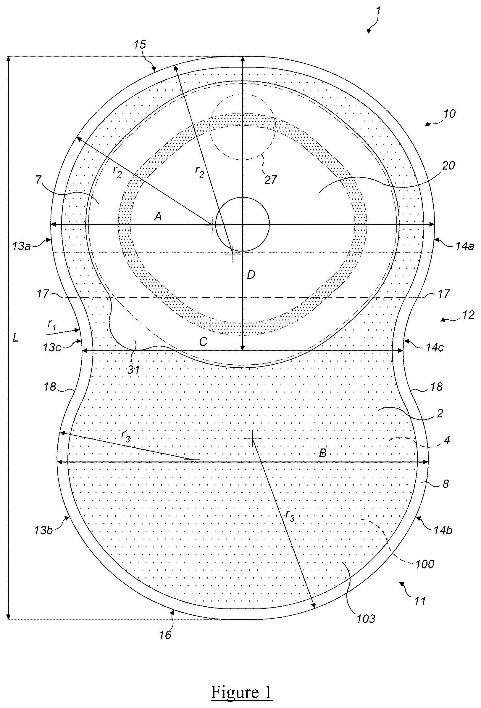 Patent US12508152 Figure 1 – Ostomy pouch