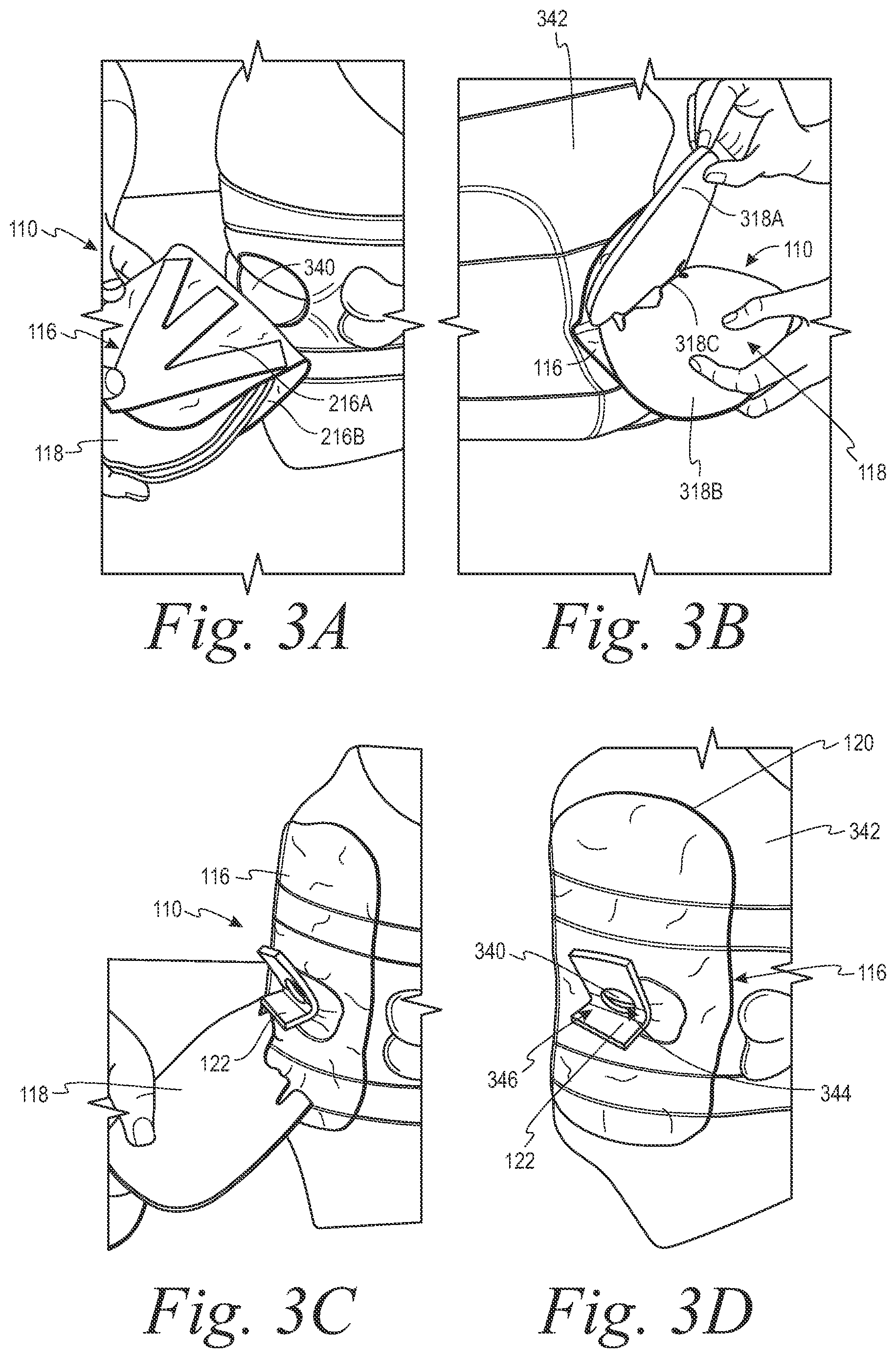 Patent US12508153 Figure 3 – Fecal collection systems and methods