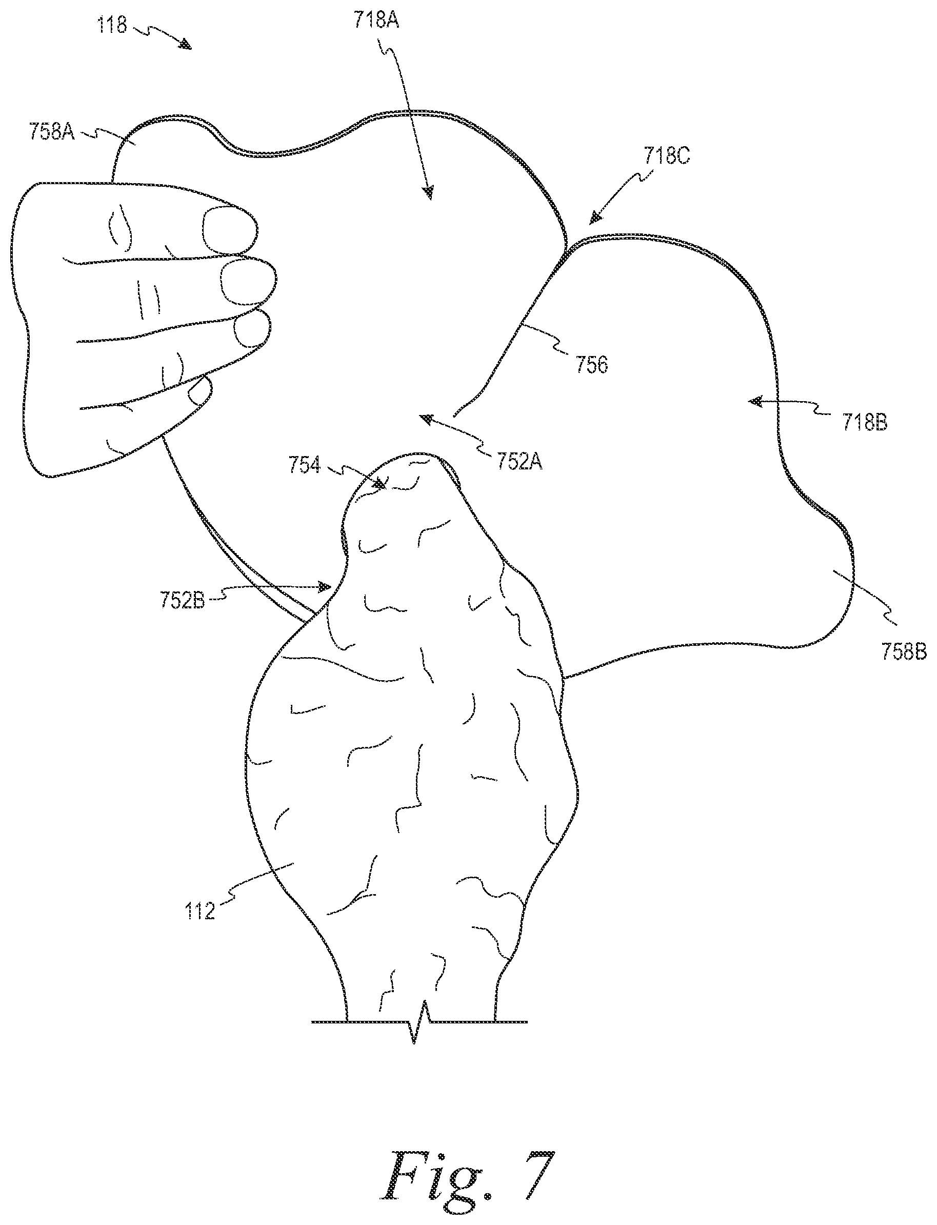 Patent US12508153 Figure 6 – Fecal collection systems and methods