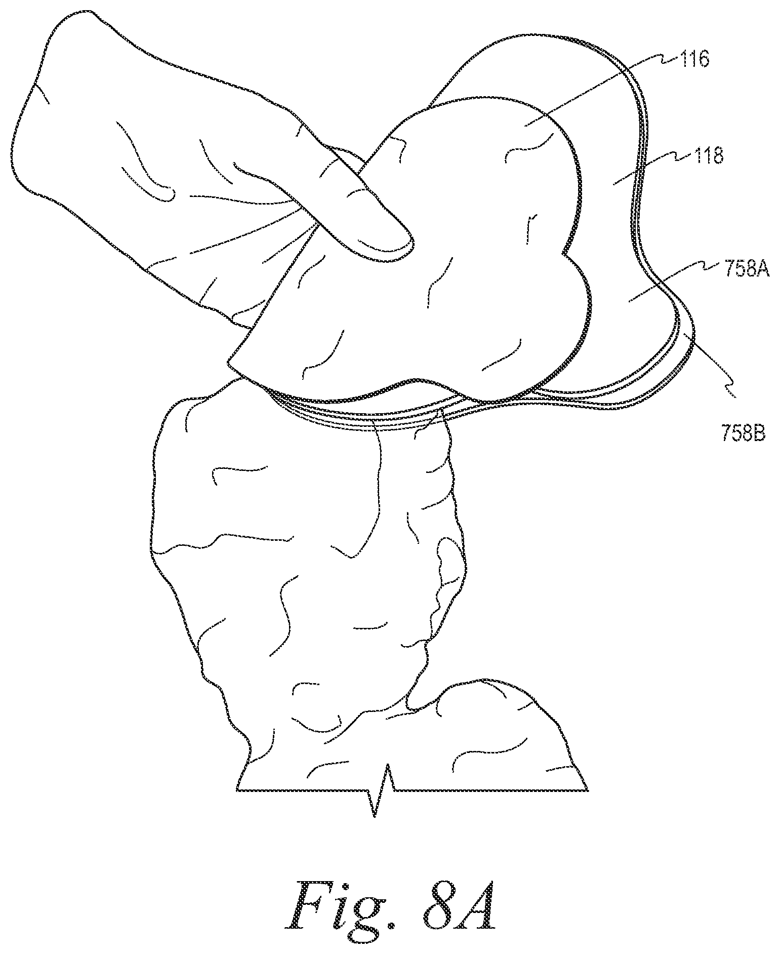Patent US12508153 Figure 7 – Fecal collection systems and methods