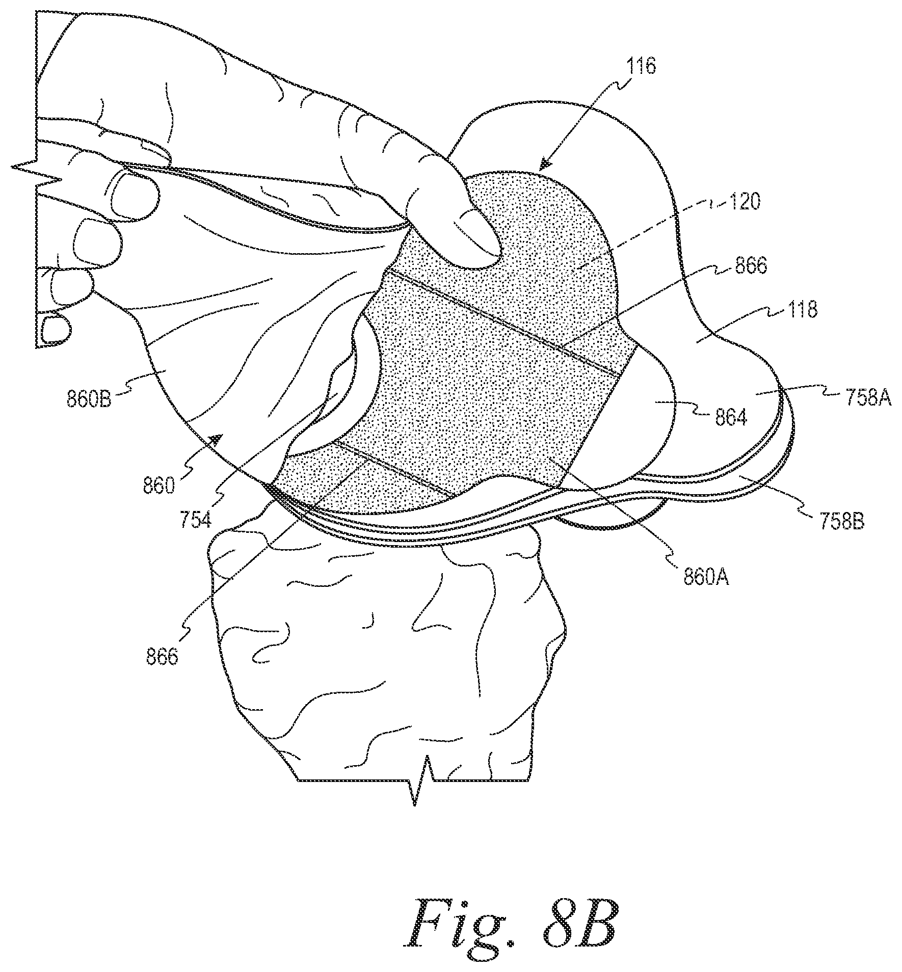 Patent US12508153 Figure 8 – Fecal collection systems and methods