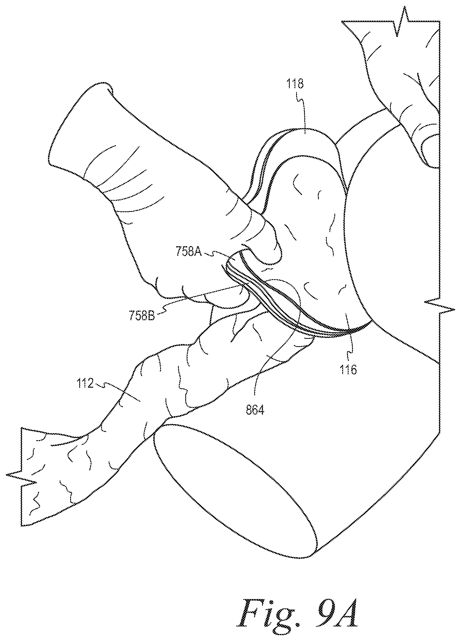 Patent US12508153 Figure 9 – Fecal collection systems and methods
