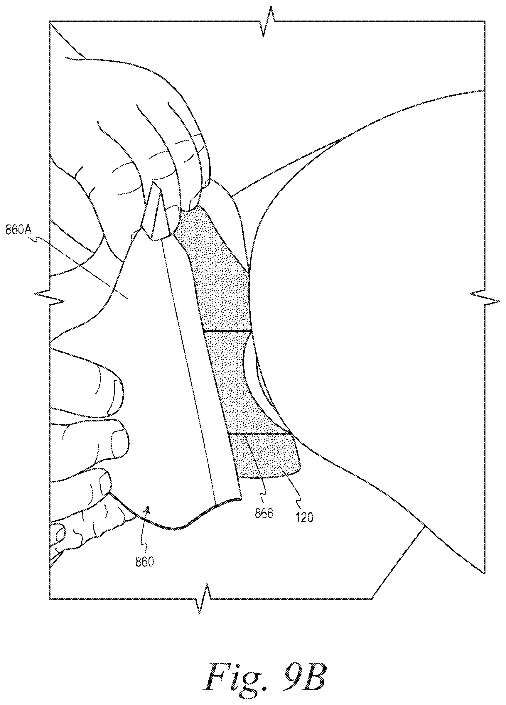 Patent US12508153 Figure 10 – Fecal collection systems and methods