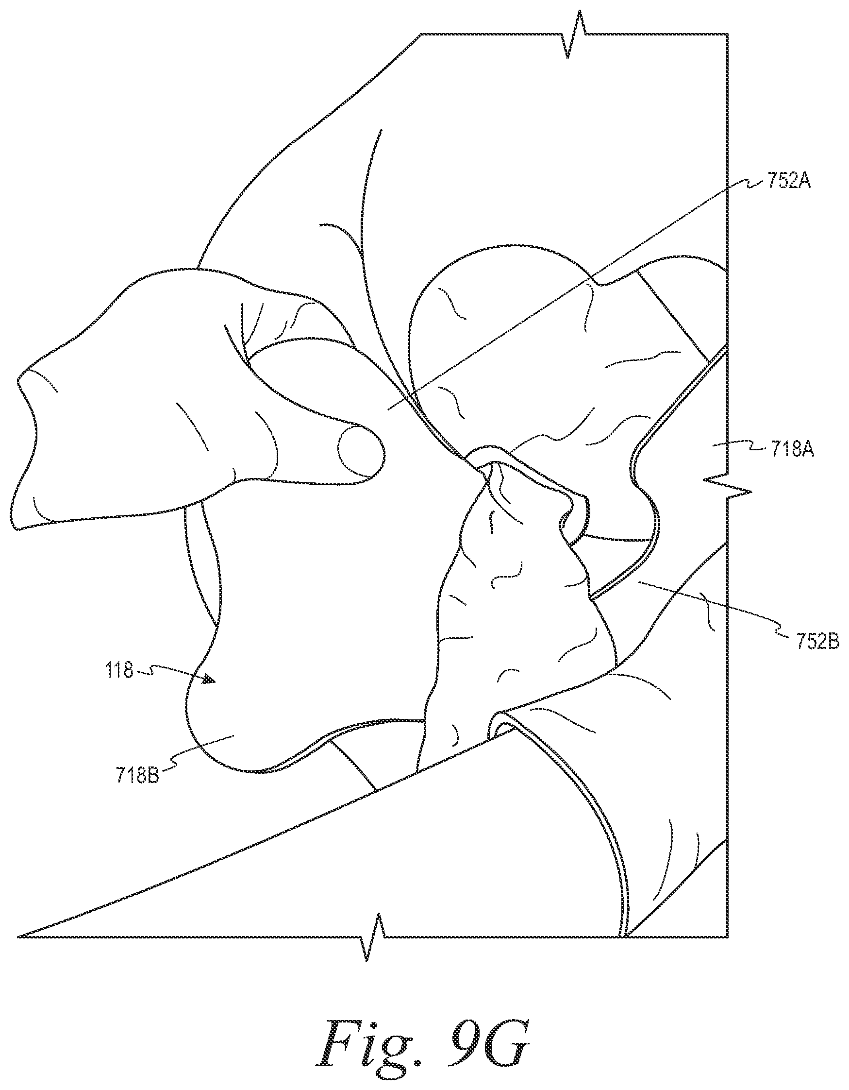 Patent US12508153 Figure 15 – Fecal collection systems and methods