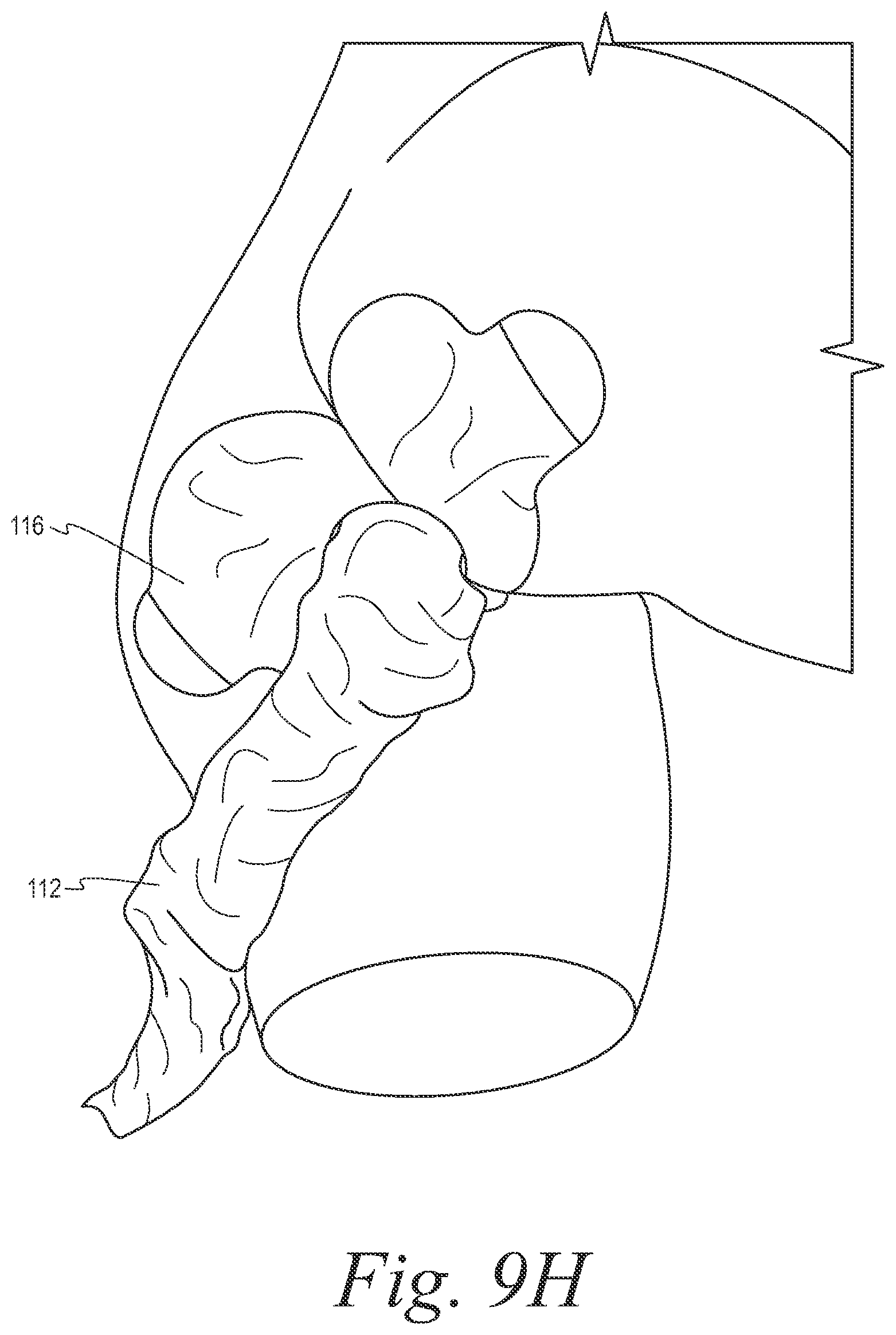 Patent US12508153 Figure 16 – Fecal collection systems and methods