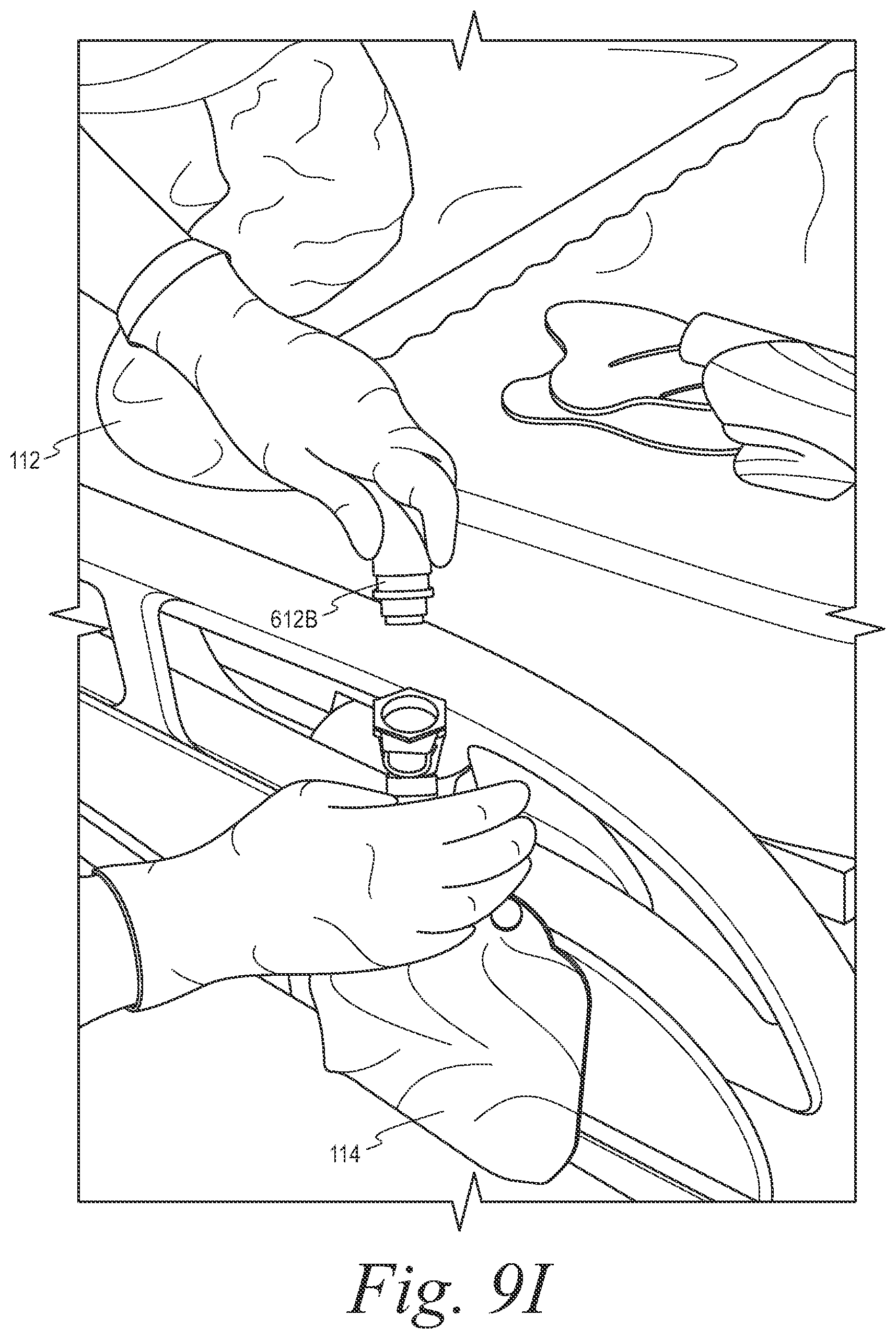 Patent US12508153 Figure 17 – Fecal collection systems and methods