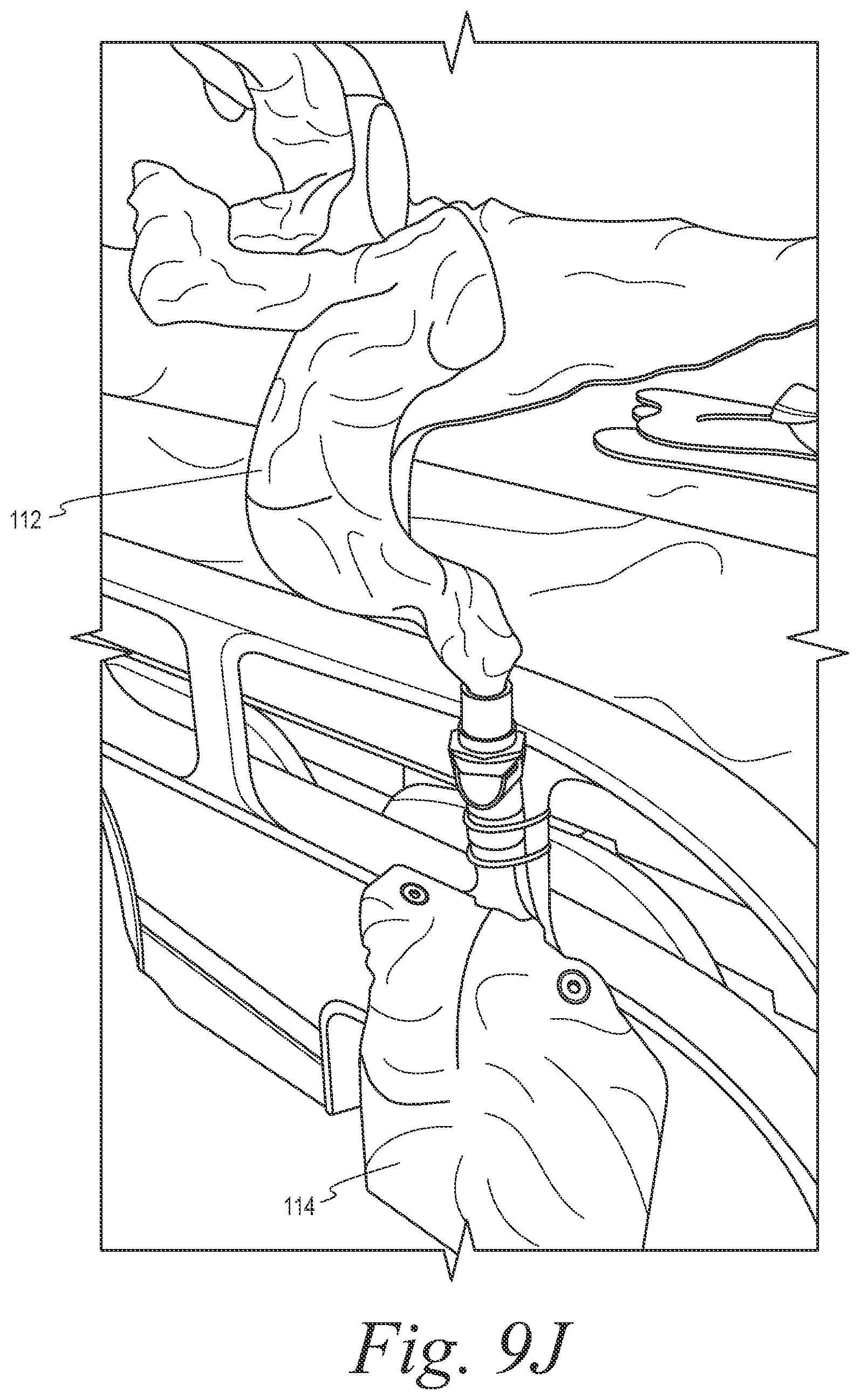 Patent US12508153 Figure 18 – Fecal collection systems and methods