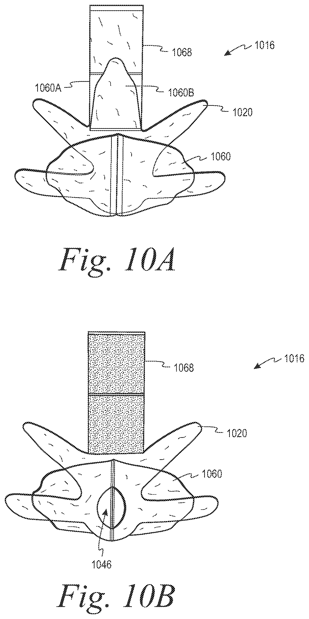 Patent US12508153 Figure 19 – Fecal collection systems and methods