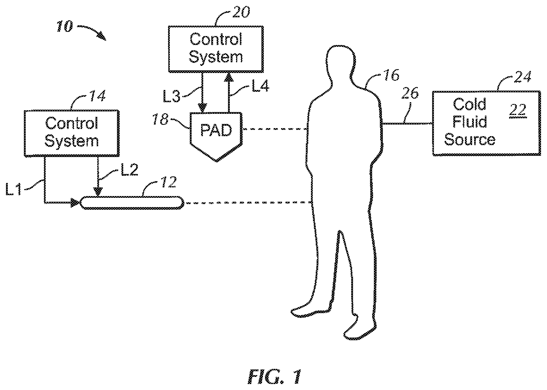 Patent US12508155 Figure 1 – Fluid cassette with polymeric membranes and integral inlet and outlet tubes for patient heat exchange system