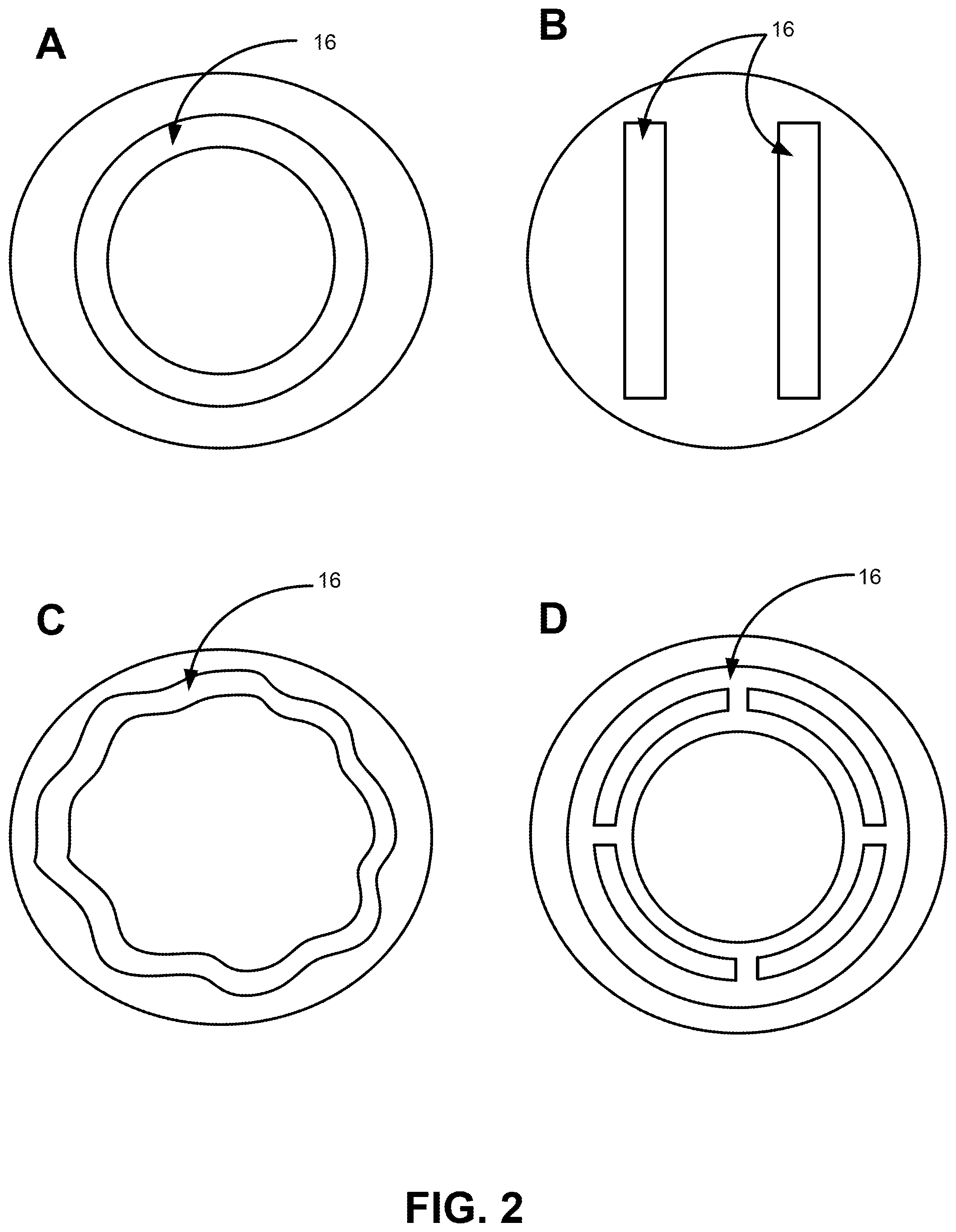 Patent US12508156 Figure 2 – Achieving uniform patterned drug release via at least one embedded microchannel in an ophthalmic device