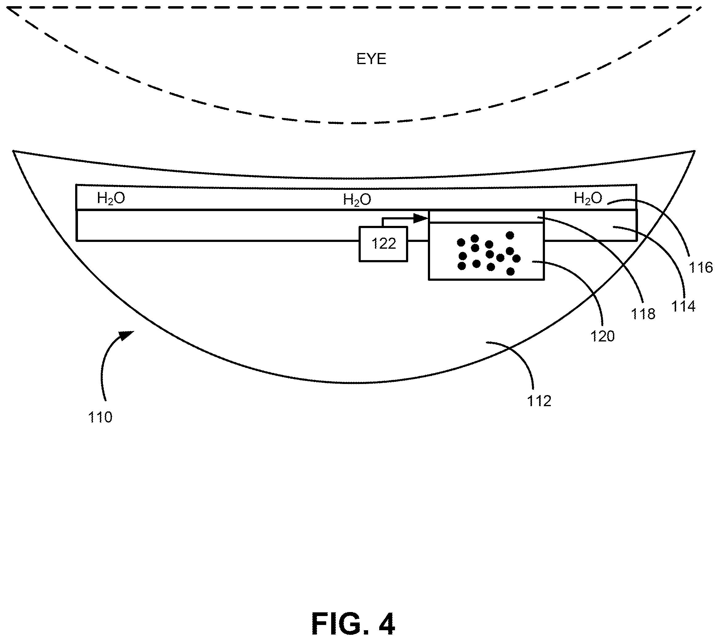 Patent US12508156 Figure 4 – Achieving uniform patterned drug release via at least one embedded microchannel in an ophthalmic device