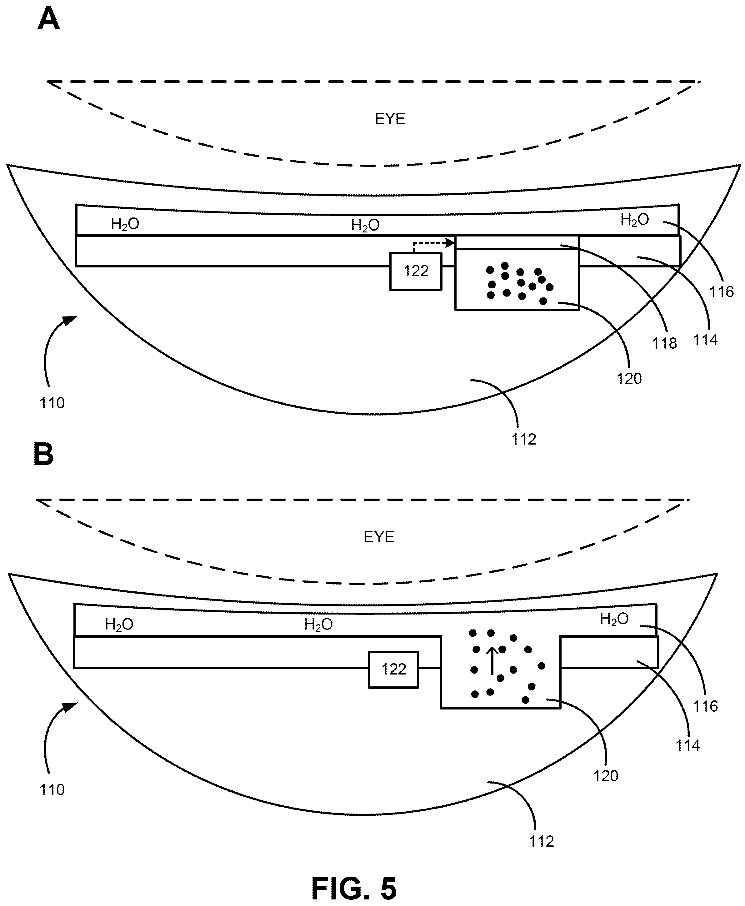 Patent US12508156 Figure 5 – Achieving uniform patterned drug release via at least one embedded microchannel in an ophthalmic device