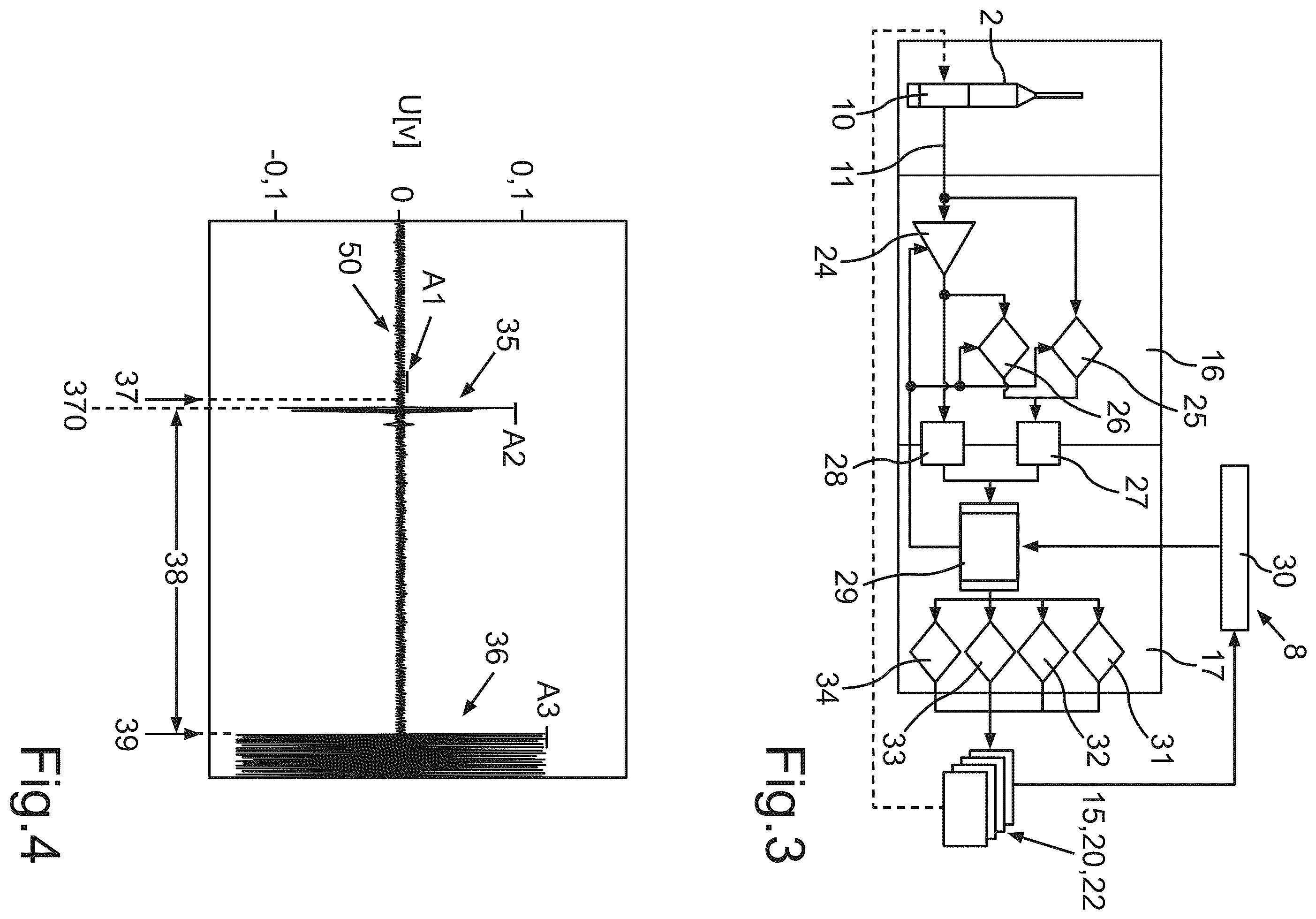Patent US12508158 Figure 2 – Console of an ophthalmic surgical system and ophthalmic surgical system