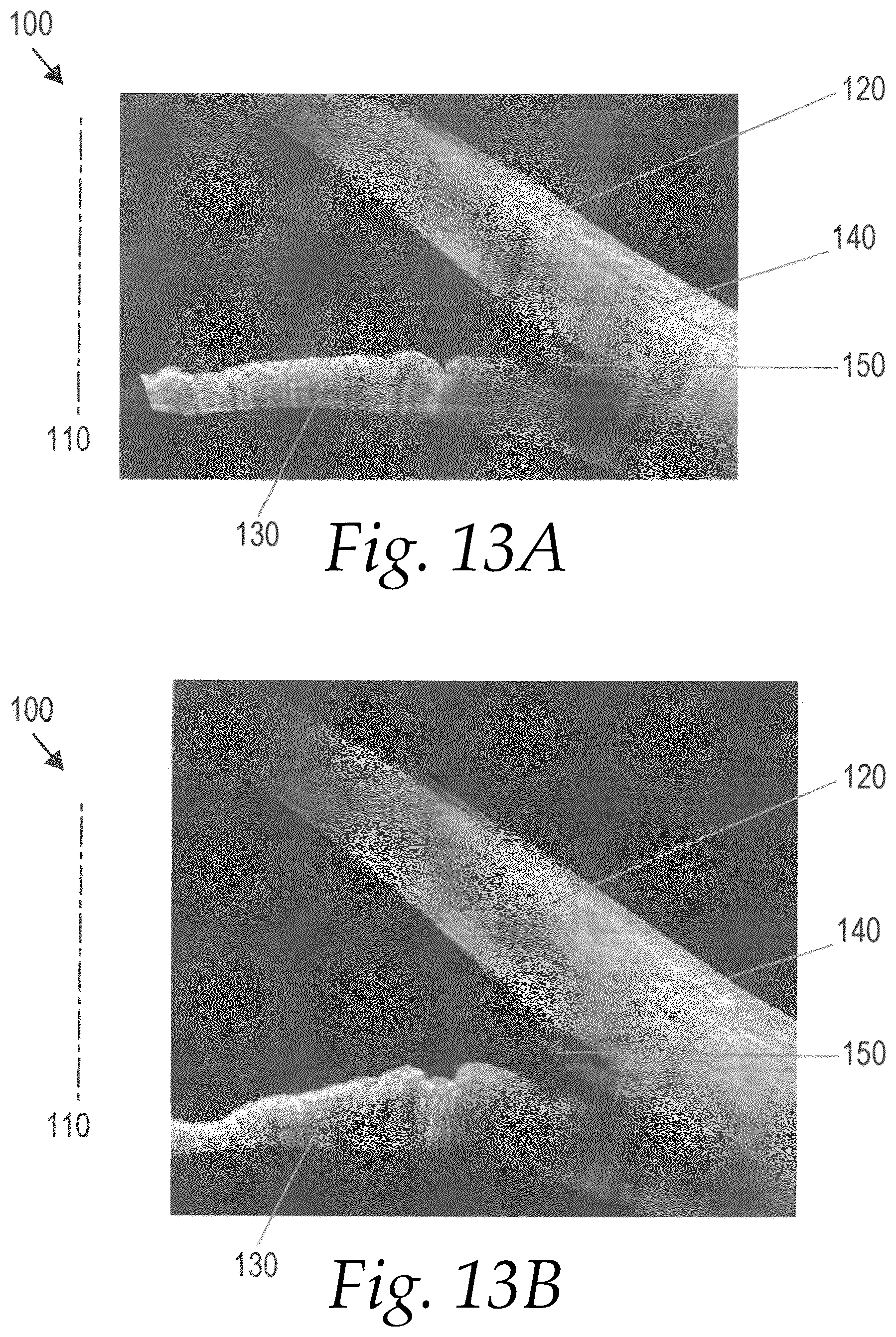 Patent US12508160 Figure 7 – Methods for treating glaucoma