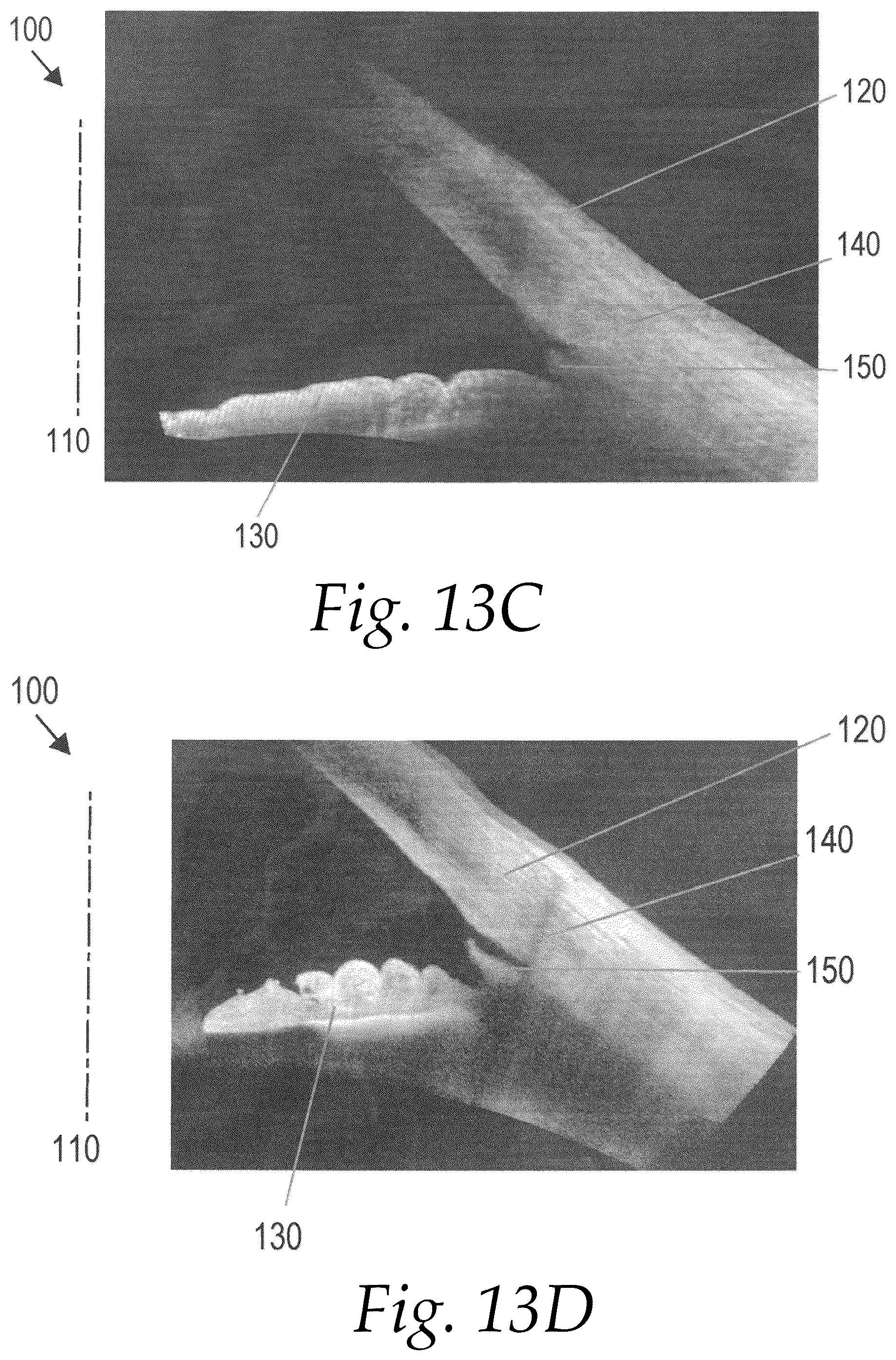 Patent US12508160 Figure 8 – Methods for treating glaucoma