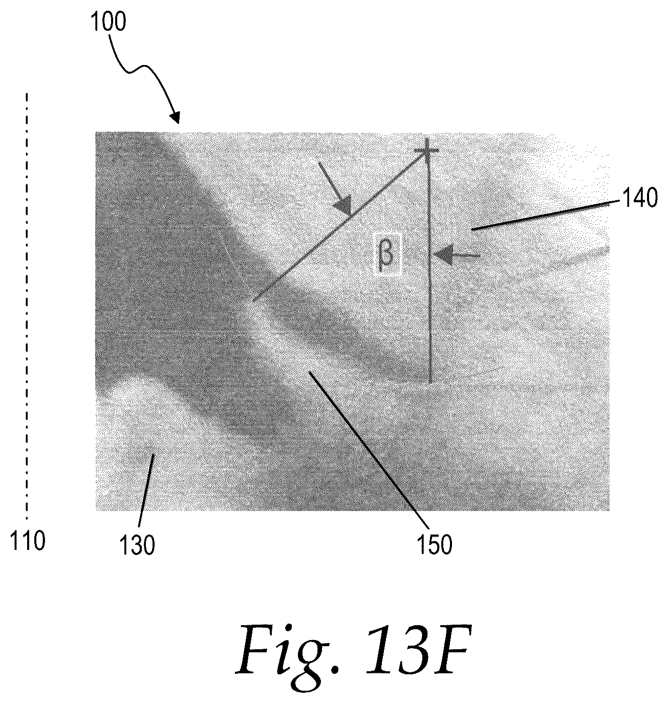 Patent US12508160 Figure 10 – Methods for treating glaucoma