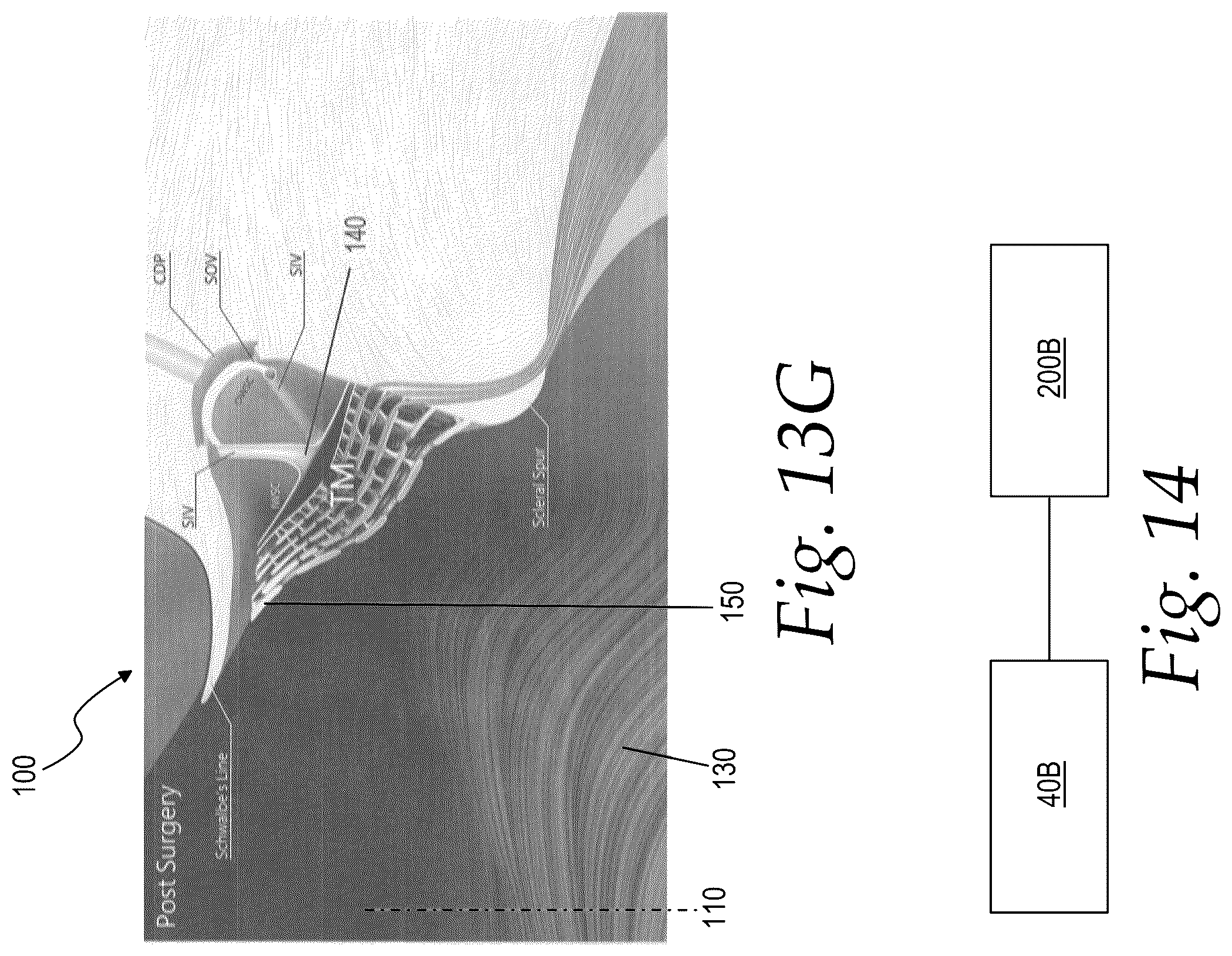 Patent US12508160 Figure 11 – Methods for treating glaucoma