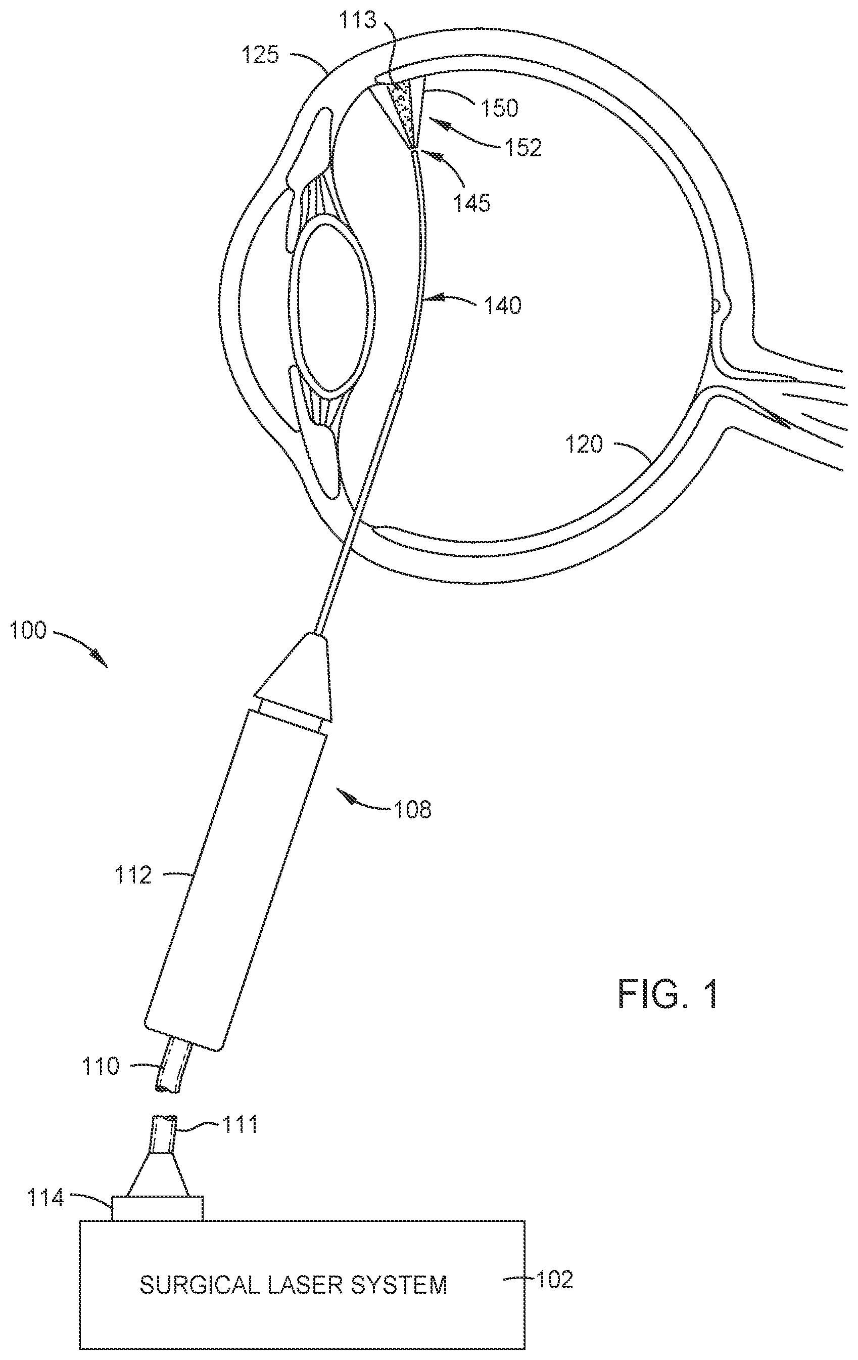 Patent US12508161 Figure 1 – Single-fiber illuminated laser probe with adjustable color