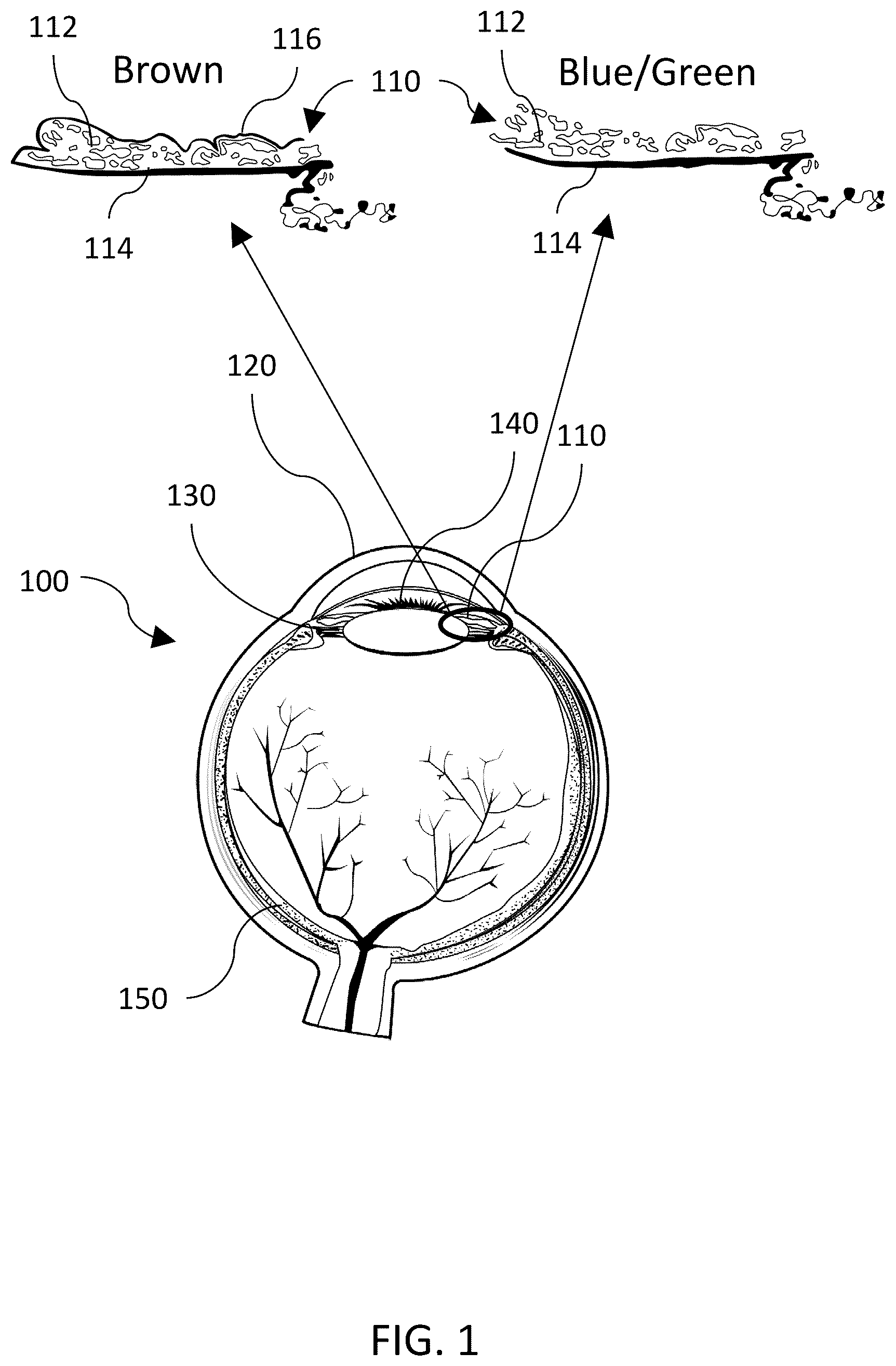 Patent US12508162 Figure 1 – Laser systems and methods for alteration of eye color