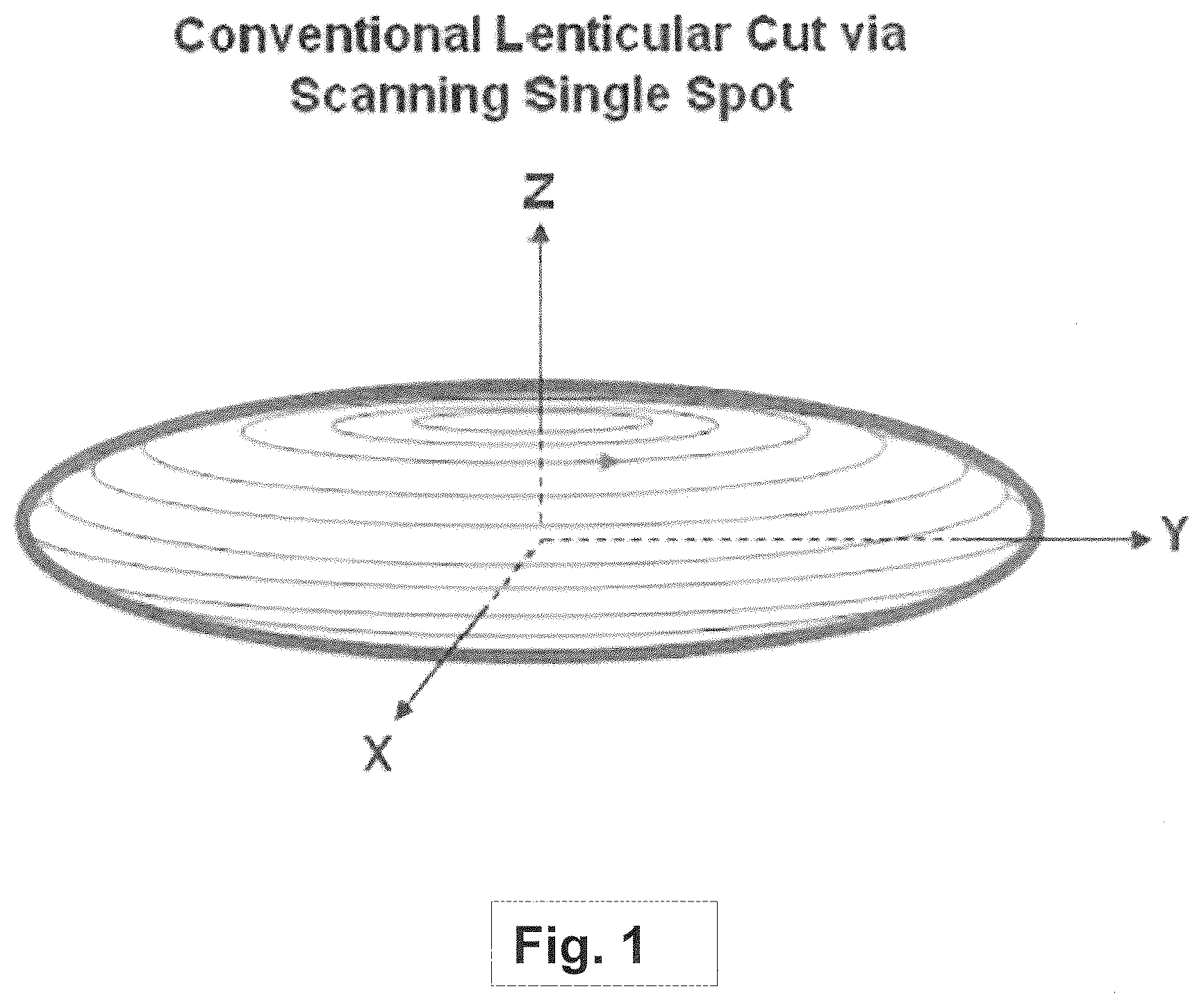 Patent US12508163 — Systems and methods for lenticular laser incision — Figure 1
