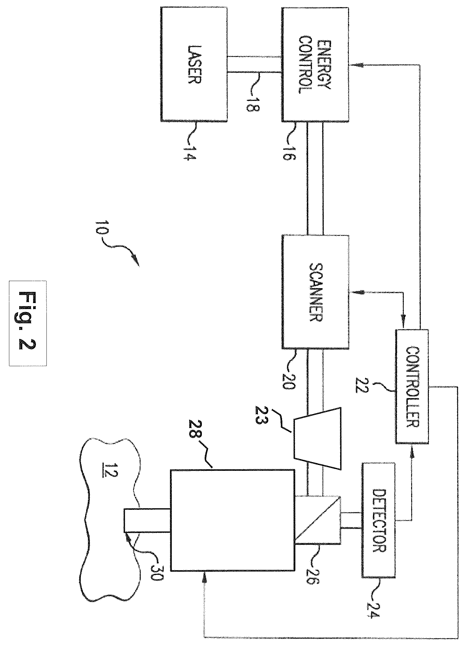 Patent US12508163 Figure 2 – Systems and methods for lenticular laser incision