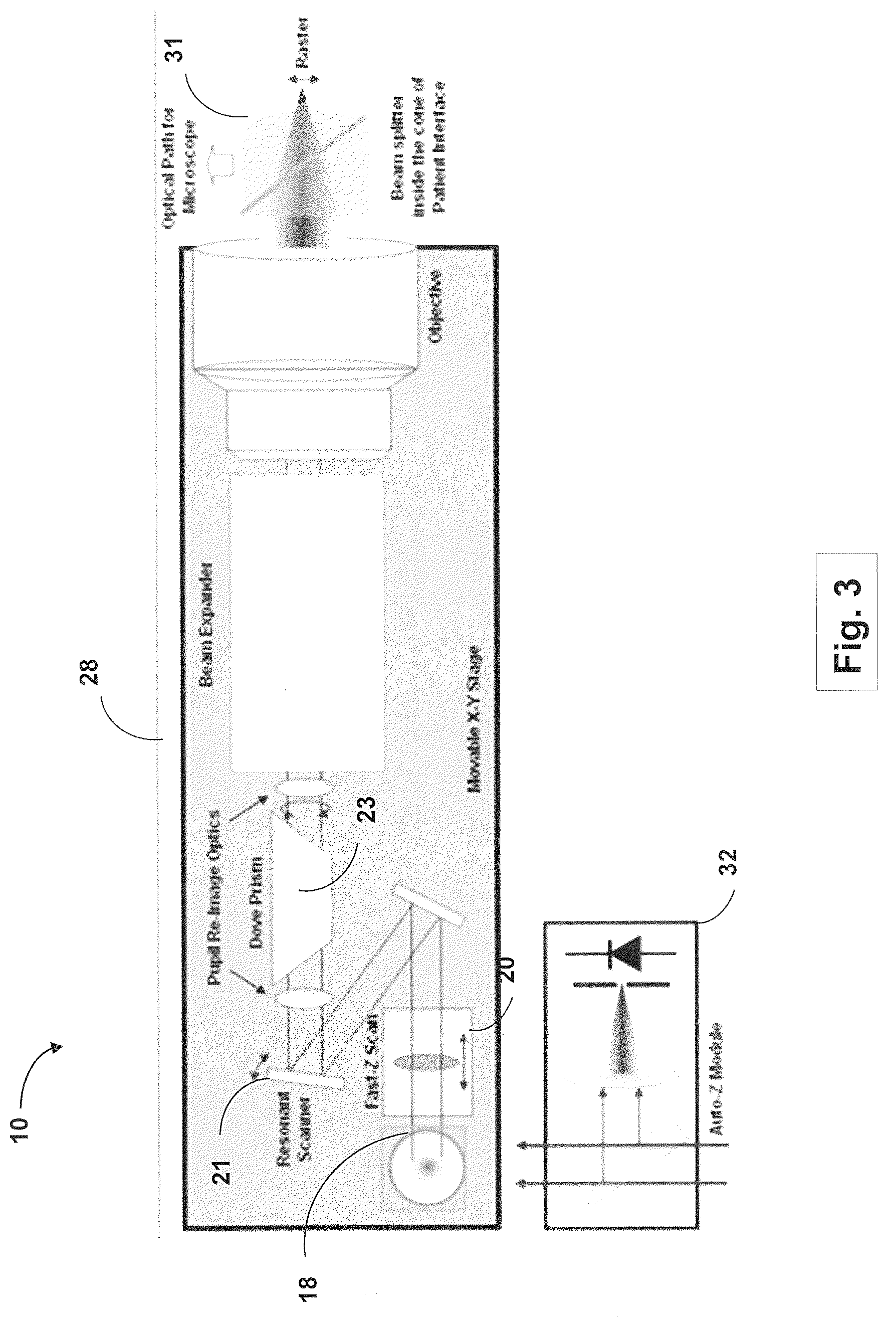 Patent US12508163 Figure 3 – Systems and methods for lenticular laser incision