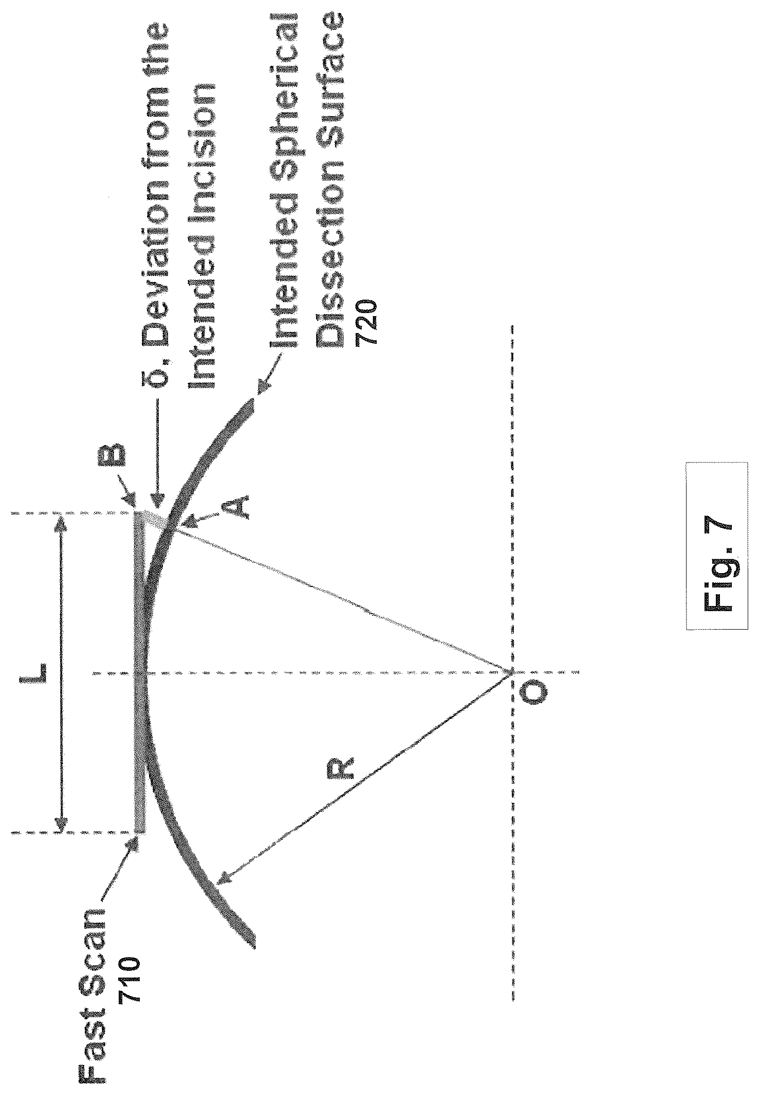 Patent US12508163 Figure 7 – Systems and methods for lenticular laser incision