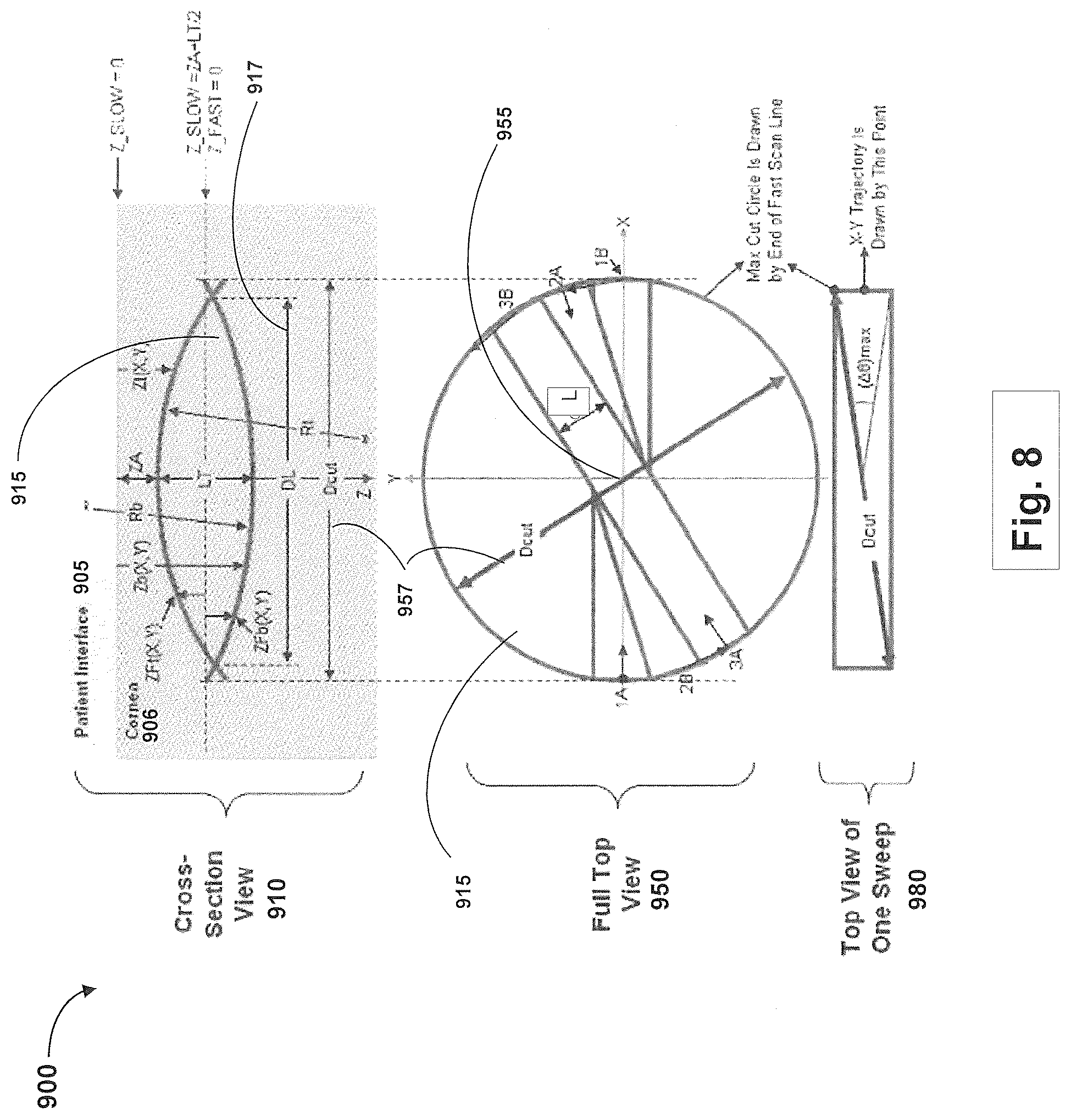 Patent US12508163 Figure 8 – Systems and methods for lenticular laser incision