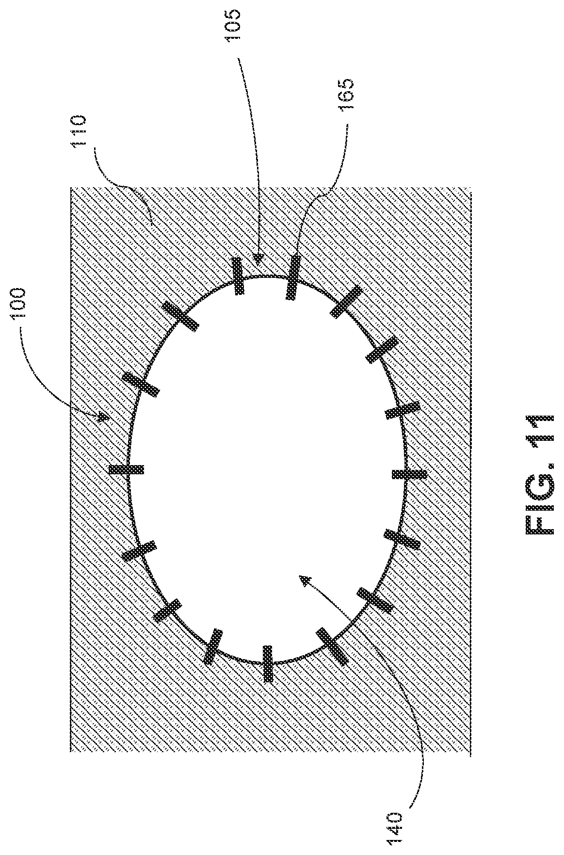 Patent US12508166 Figure 6 – Wound bolster dressing and method of use