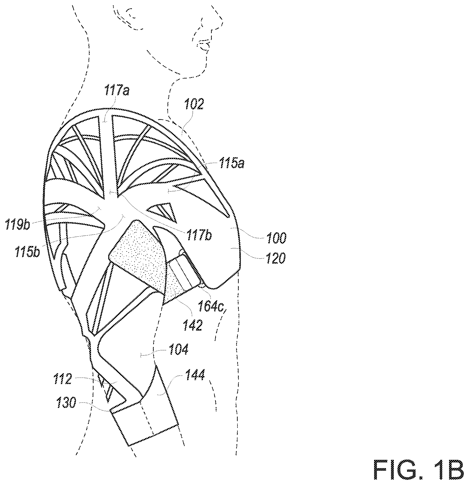 Patent US12508168 Figure 2 – Arm sleeve that provides assistance during an arm motion