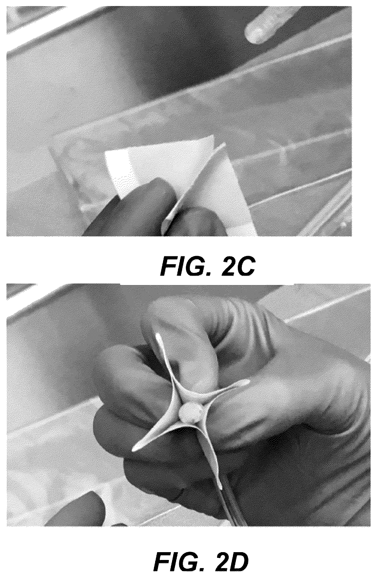 Patent US12508171 Figure 9 – Delivery systems for control of bleeding in transurethral prostatectomy
