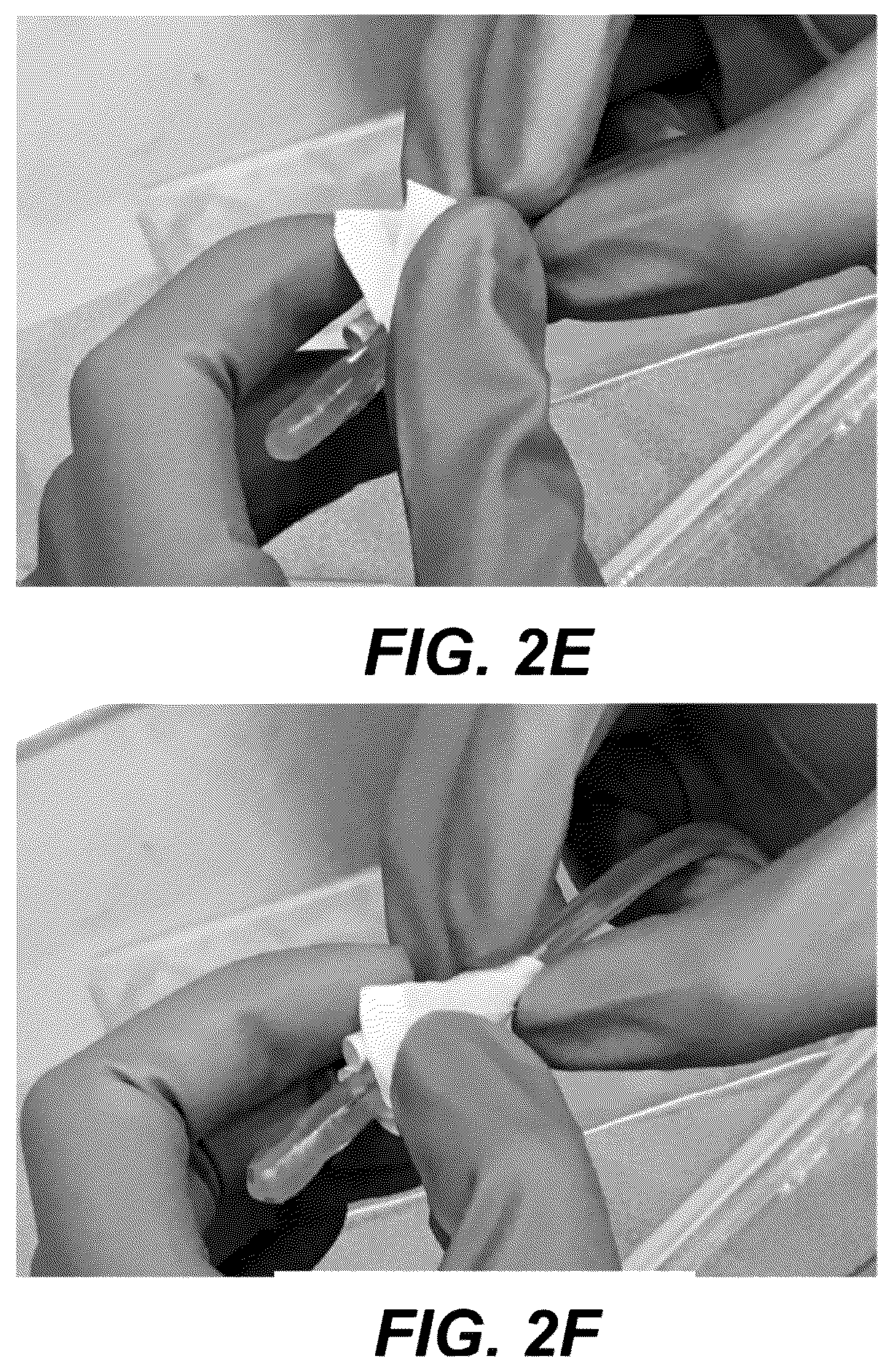 Patent US12508171 Figure 10 – Delivery systems for control of bleeding in transurethral prostatectomy