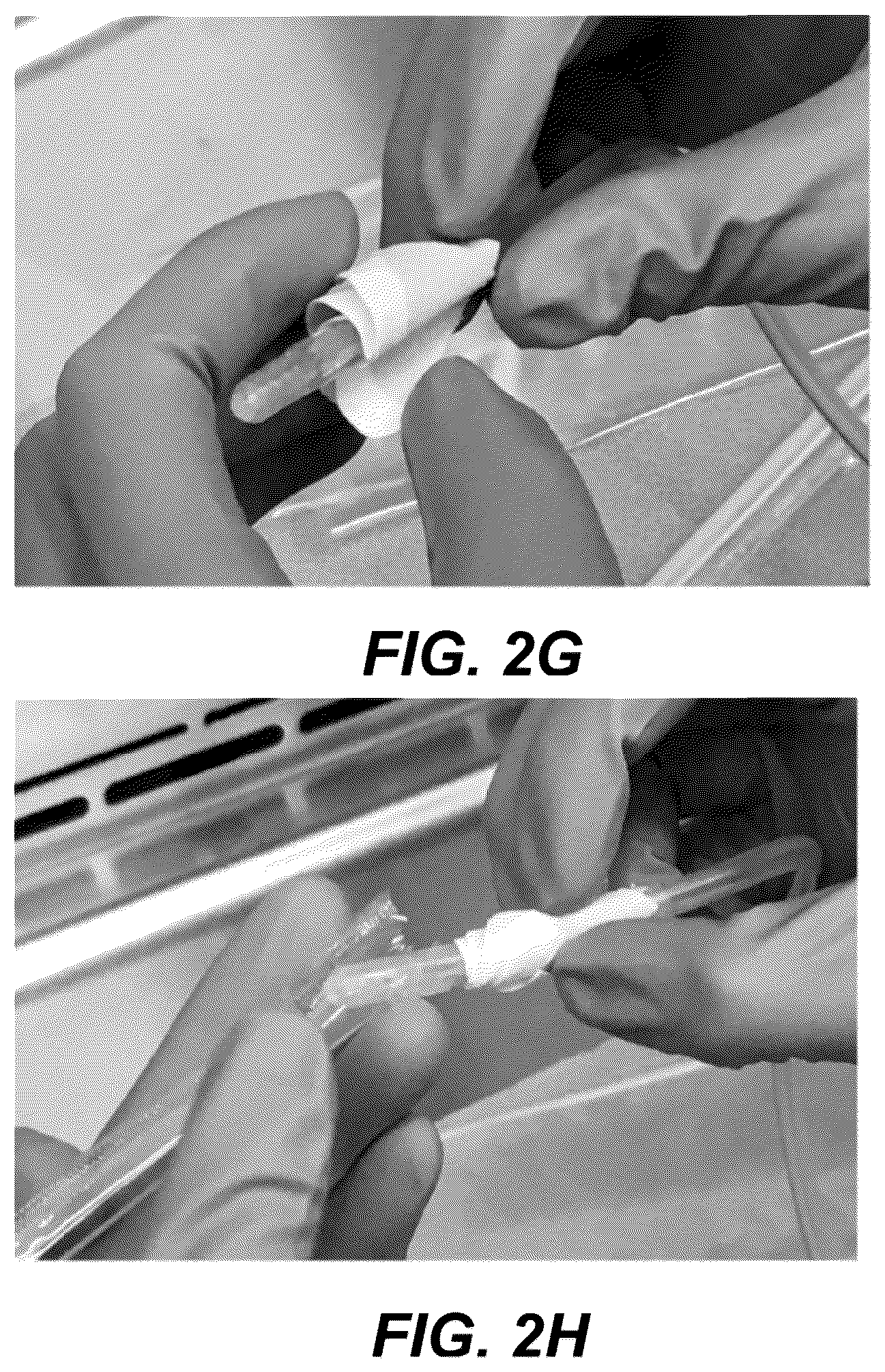 Patent US12508171 Figure 11 – Delivery systems for control of bleeding in transurethral prostatectomy