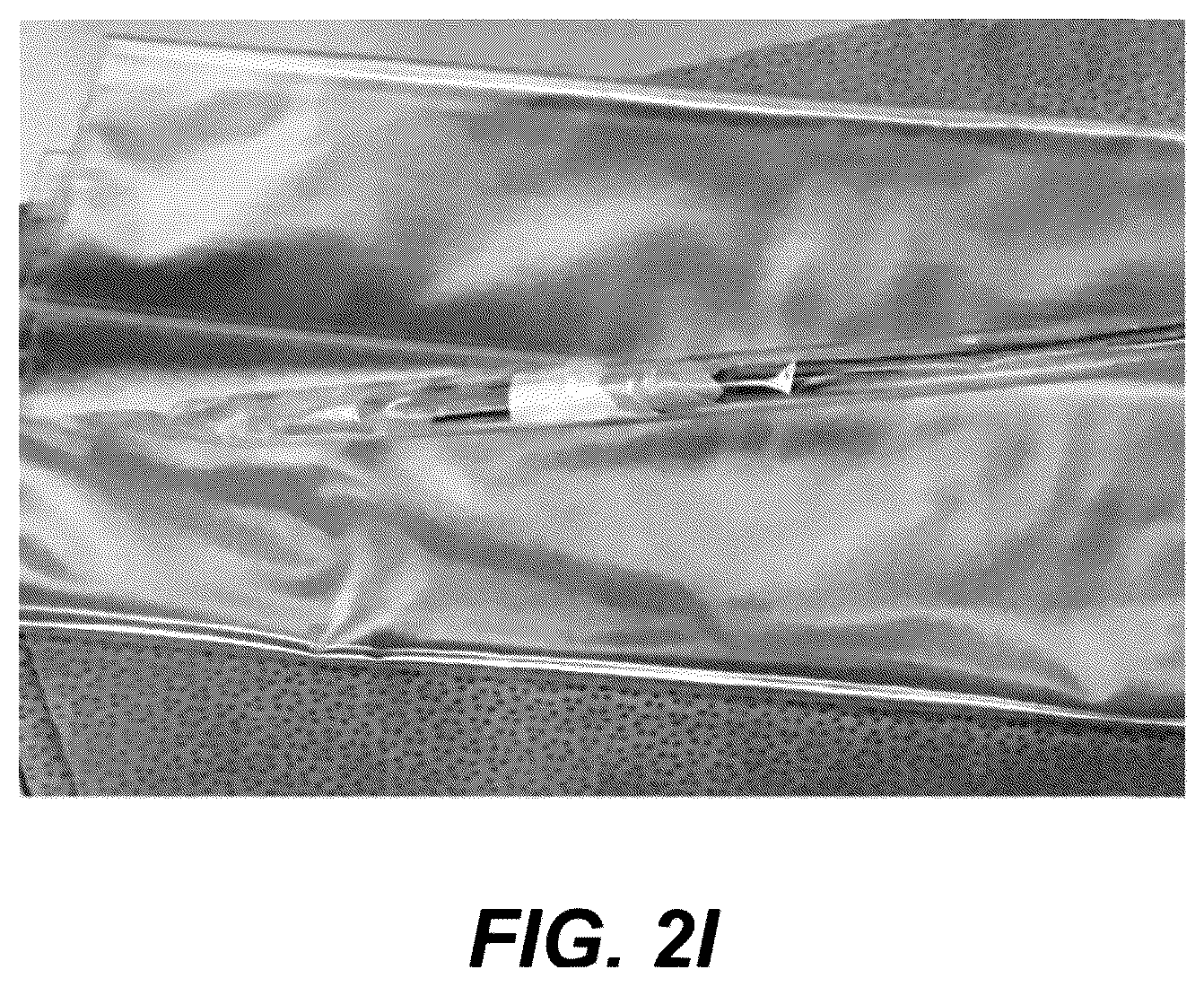 Patent US12508171 Figure 12 – Delivery systems for control of bleeding in transurethral prostatectomy