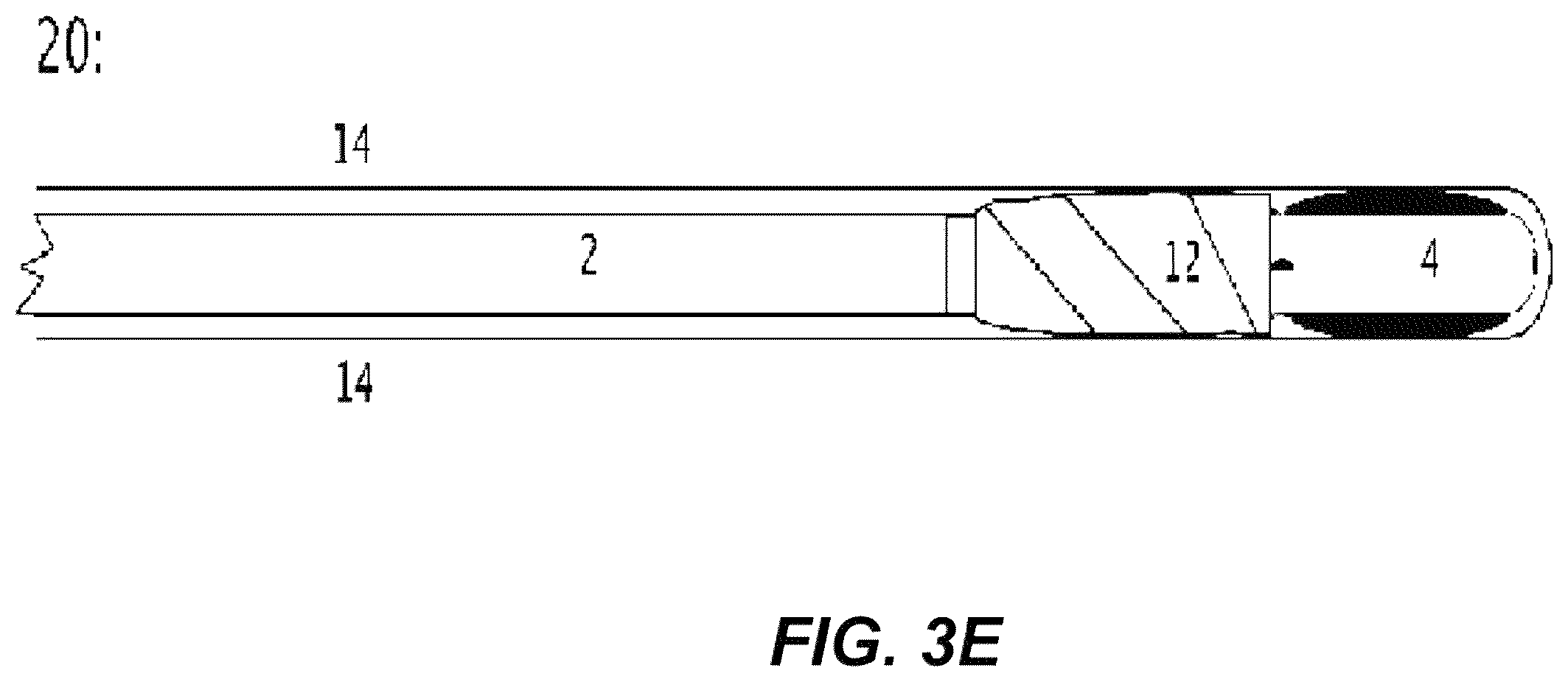 Patent US12508171 Figure 17 – Delivery systems for control of bleeding in transurethral prostatectomy
