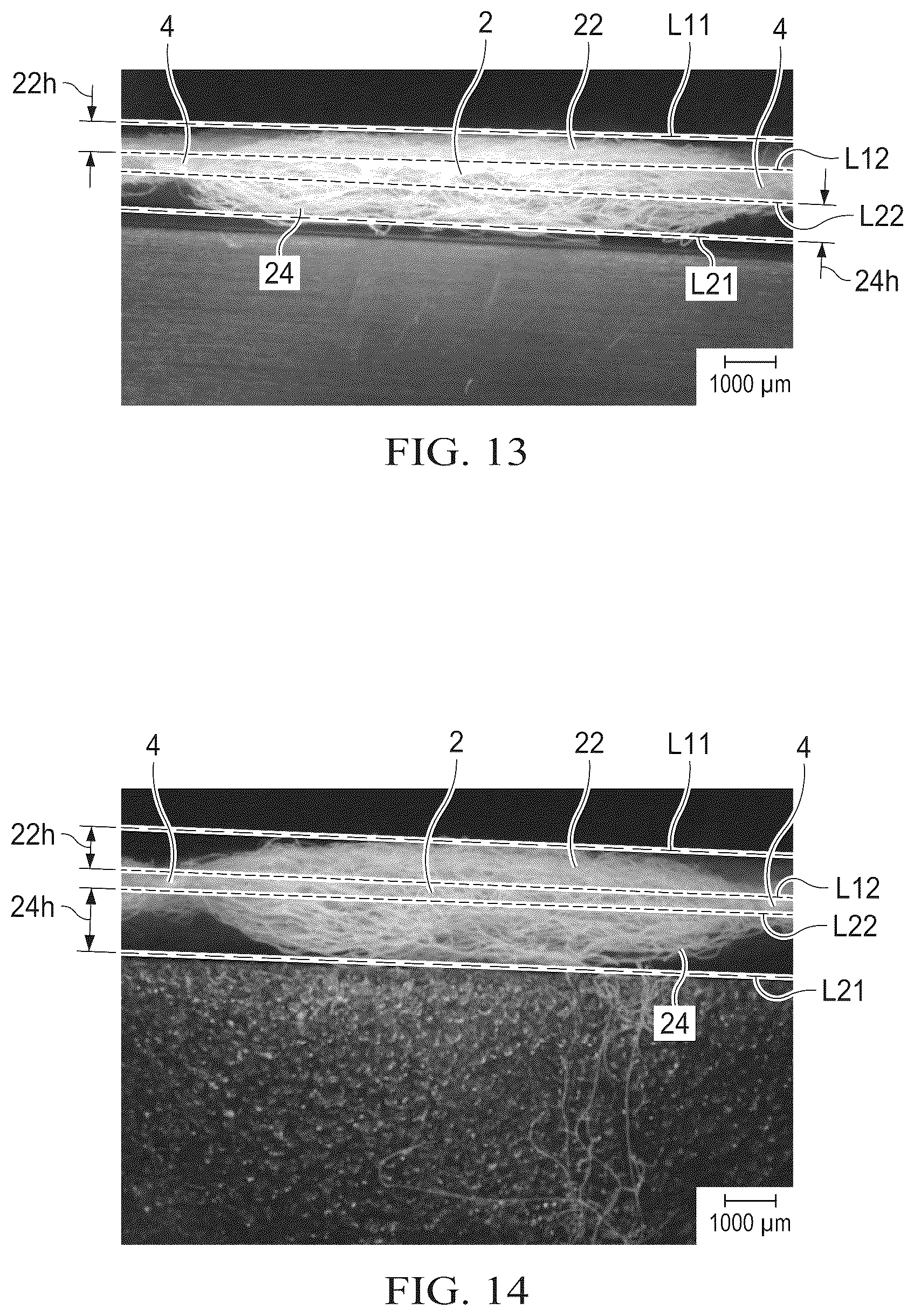 Patent US12508174 Figure 6 – Nonwoven and absorbent articles having the same