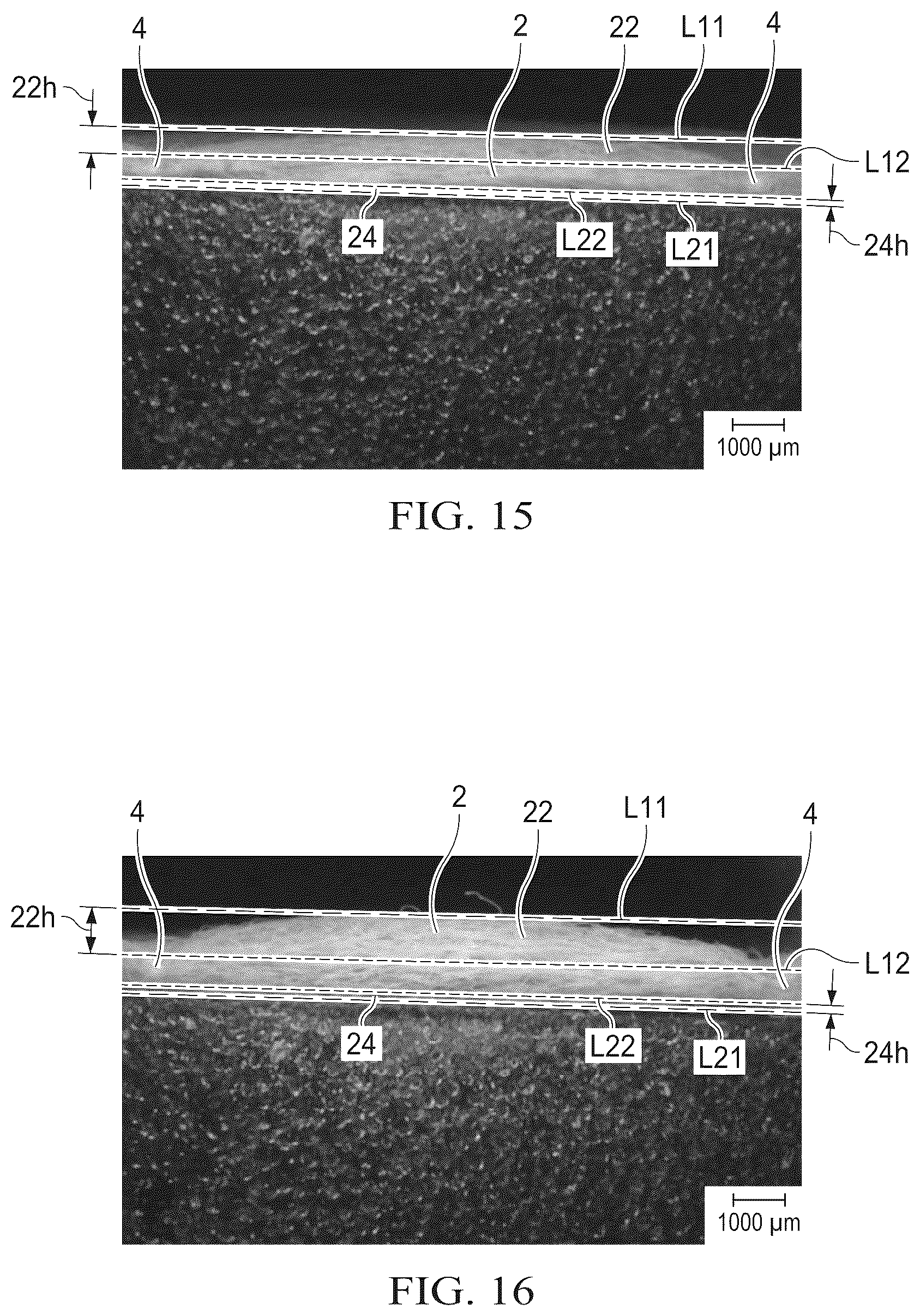 Patent US12508174 Figure 7 – Nonwoven and absorbent articles having the same