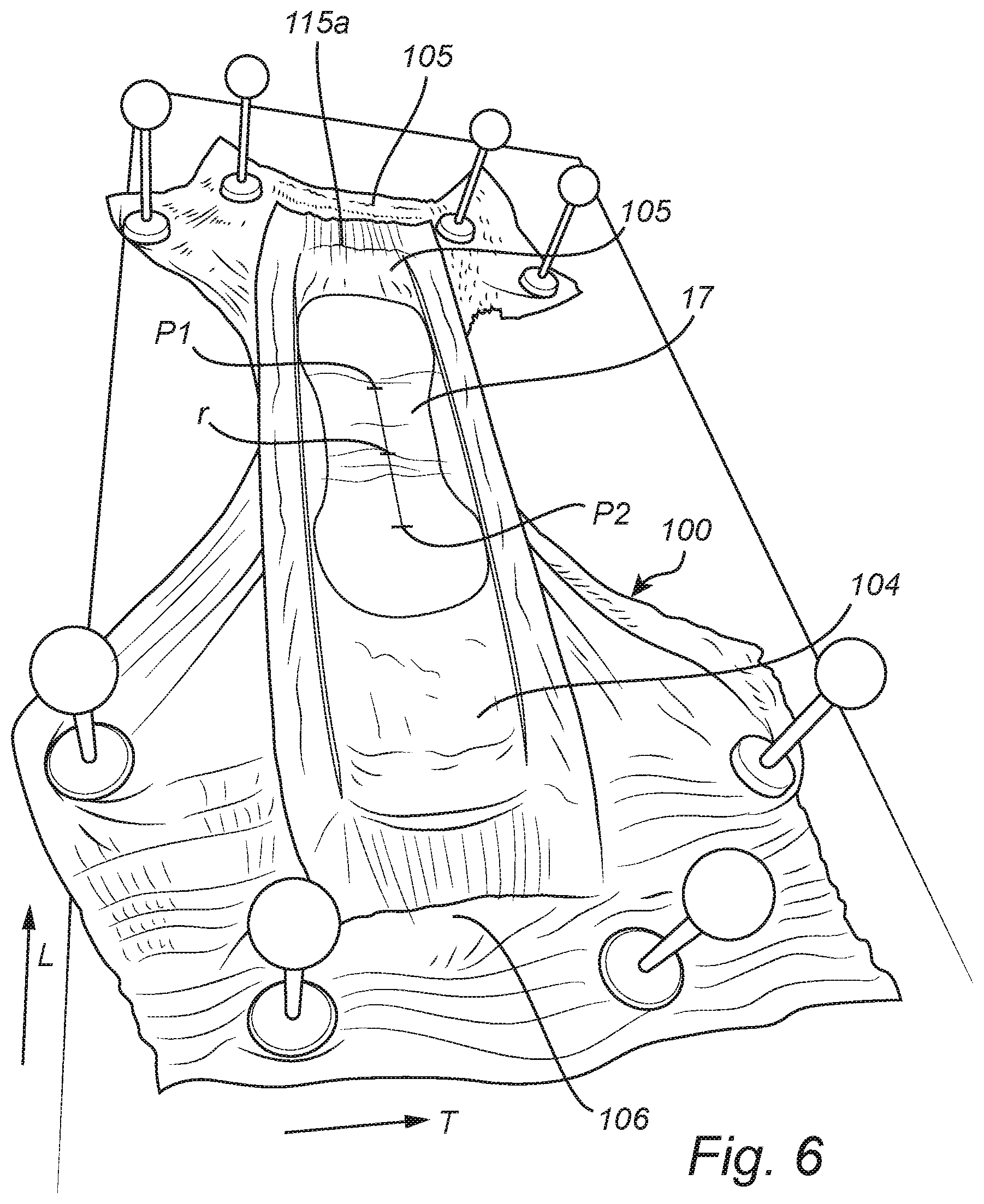Patent US12508175 Figure 6 – Absorbent article comprising a lubricant agent