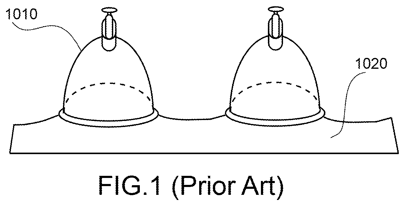 Patent US12508189 Figure 1 – Methods and apparatus for treating pain and mobility impairment