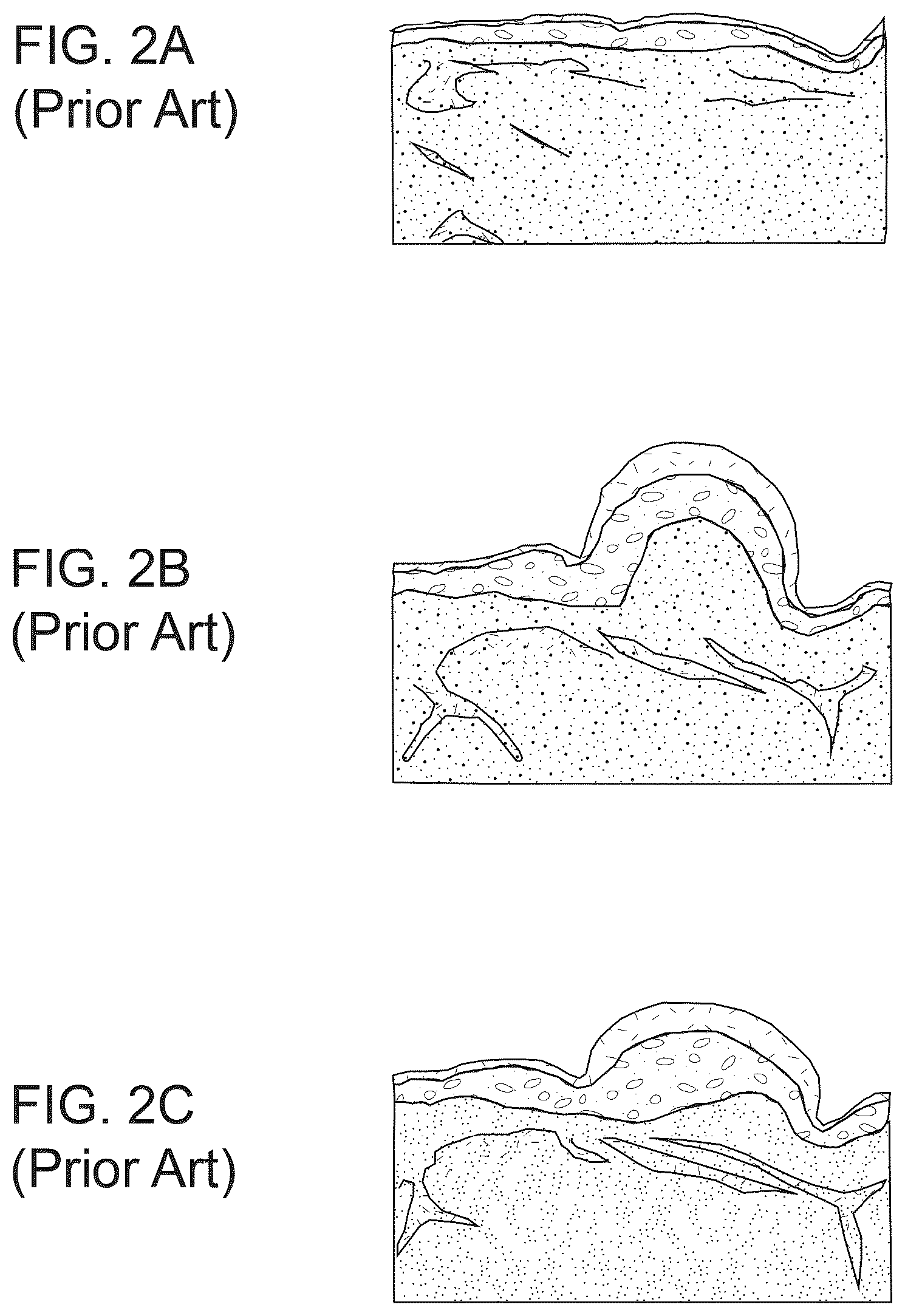 Patent US12508189 Figure 2 – Methods and apparatus for treating pain and mobility impairment