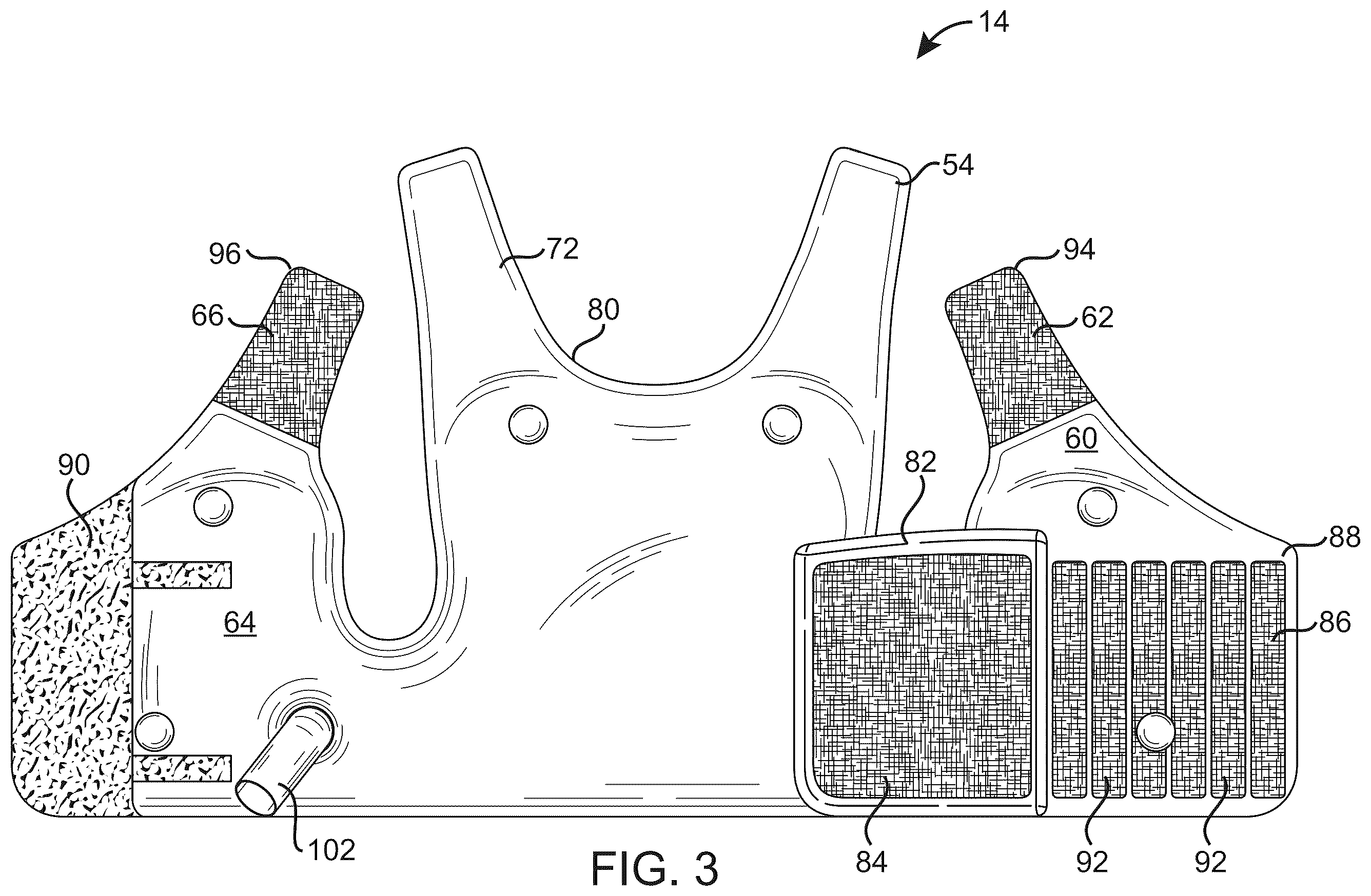 Patent US12508191 Figure 3 – High frequency chest wall oscillation air pulse generator having pressure sensor for feedback control