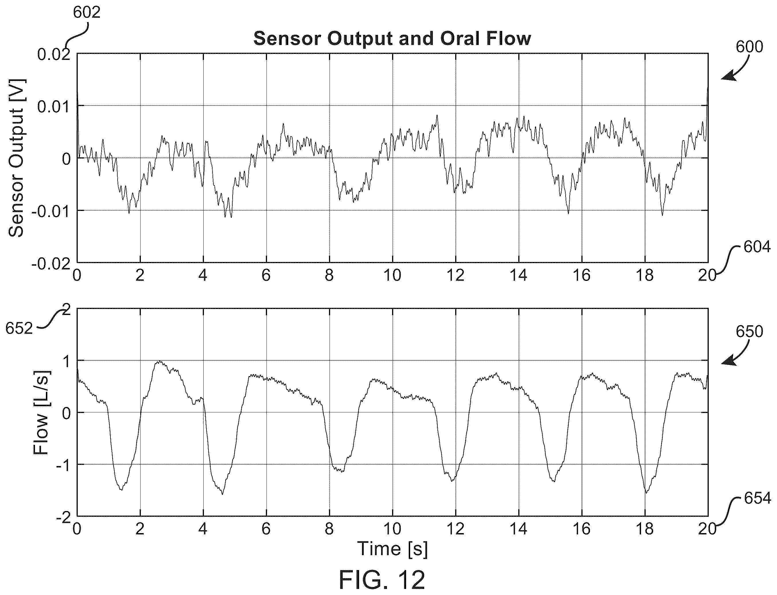 Patent US12508191 Figure 12 – High frequency chest wall oscillation air pulse generator having pressure sensor for feedback control