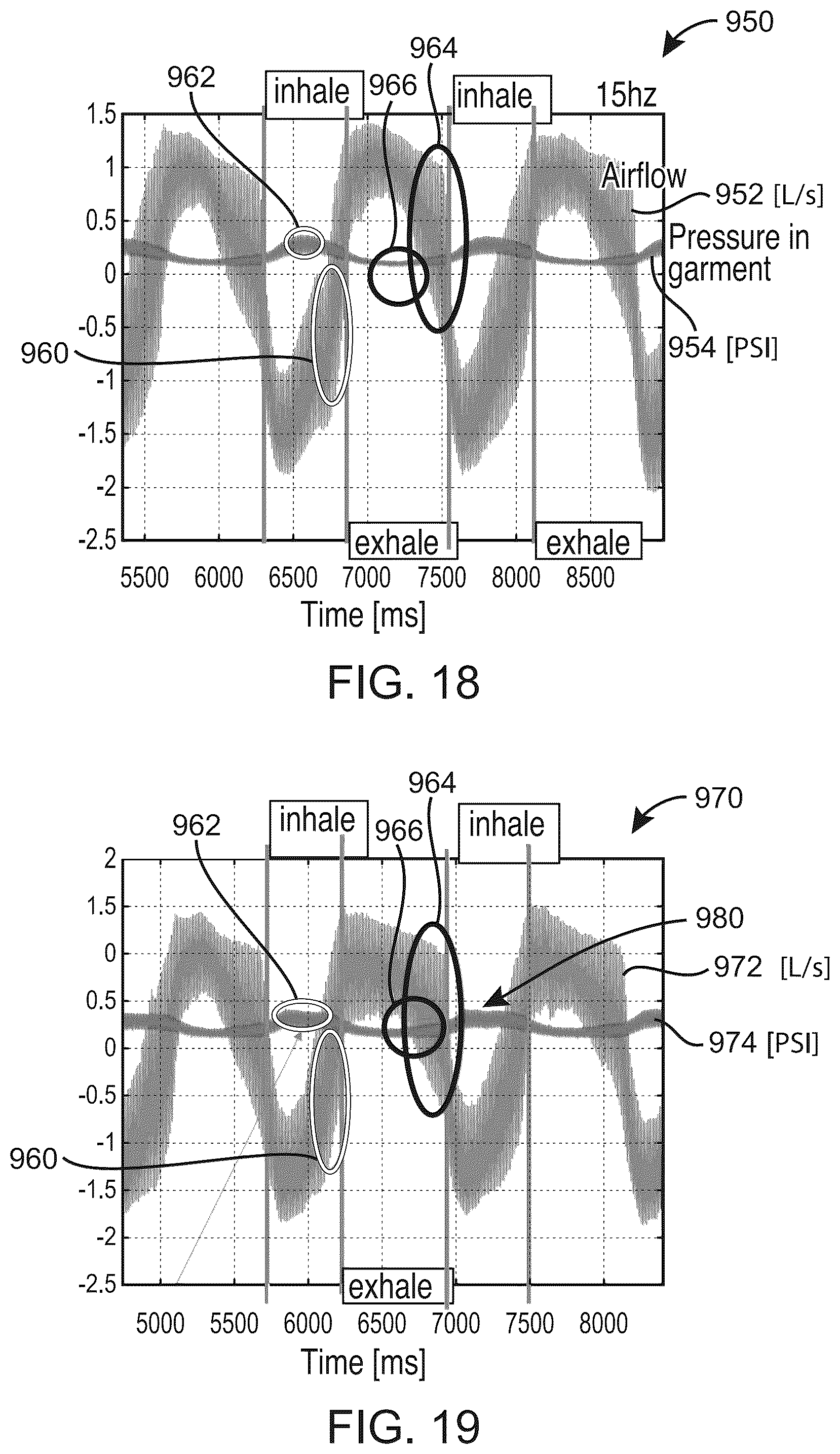 Patent US12508191 Figure 16 – High frequency chest wall oscillation air pulse generator having pressure sensor for feedback control