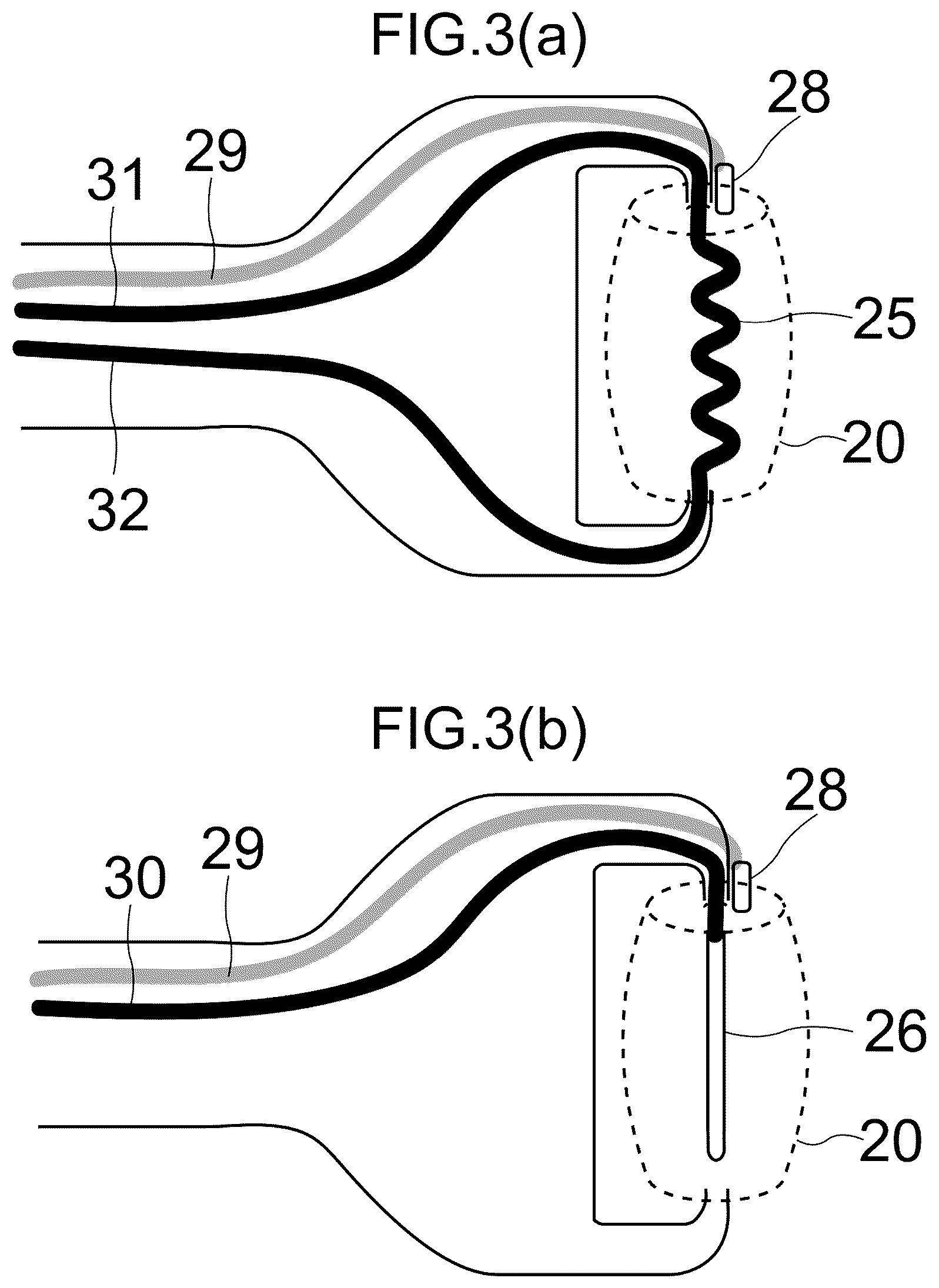 Patent US12508192 Figure 3 – Device and method for dry eye treatment