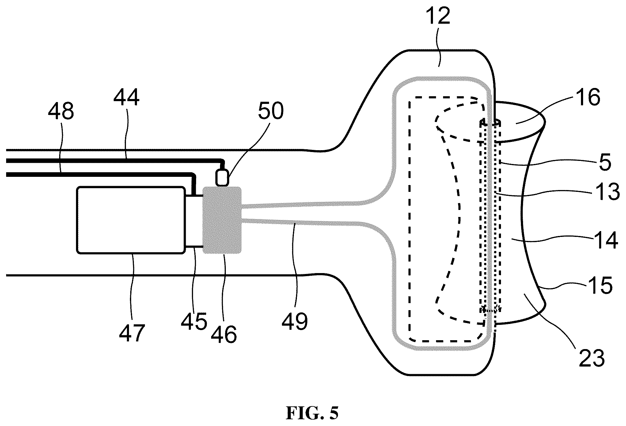 Patent US12508192 Figure 5 – Device and method for dry eye treatment