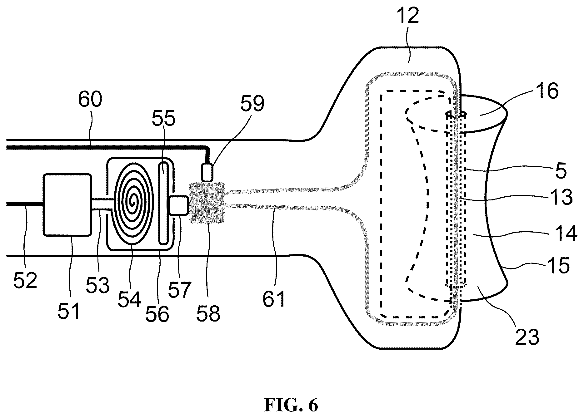 Patent US12508192 Figure 6 – Device and method for dry eye treatment