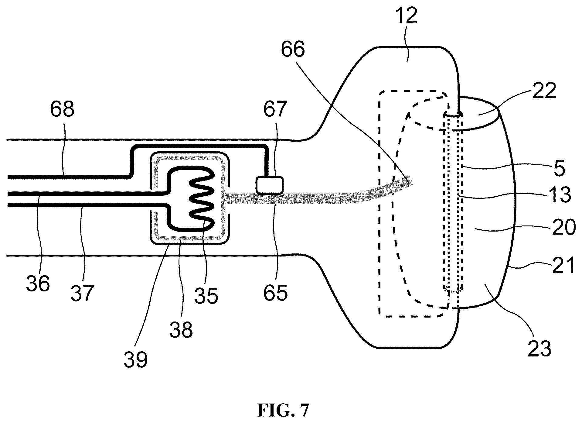 Patent US12508192 Figure 7 – Device and method for dry eye treatment